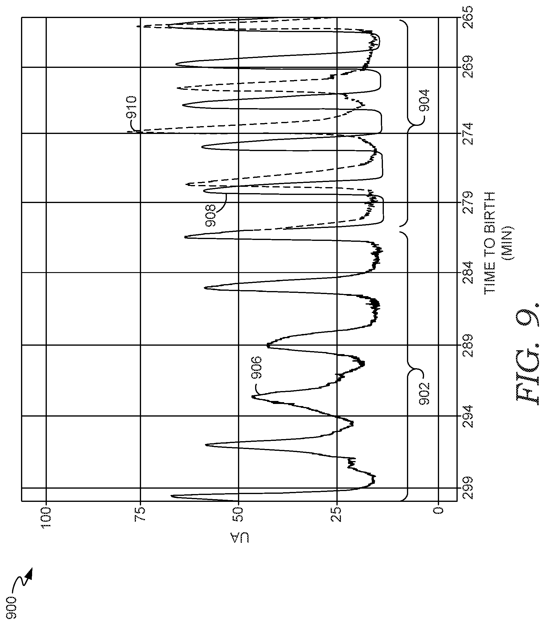 Patent US11776690 Figure 11 – Forecasting uterine activity