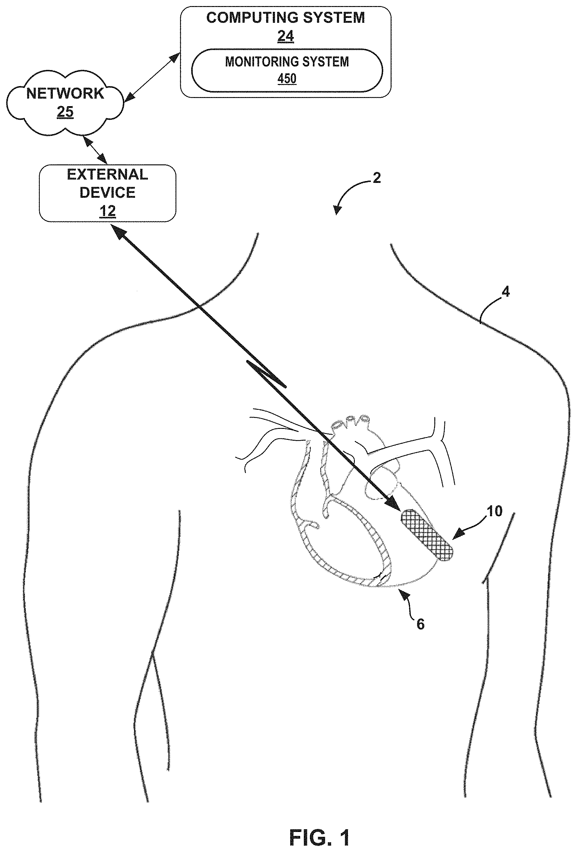 Patent US11776691 Figure 1 – Machine learning based depolarization identification and arrhythmia localization visualization