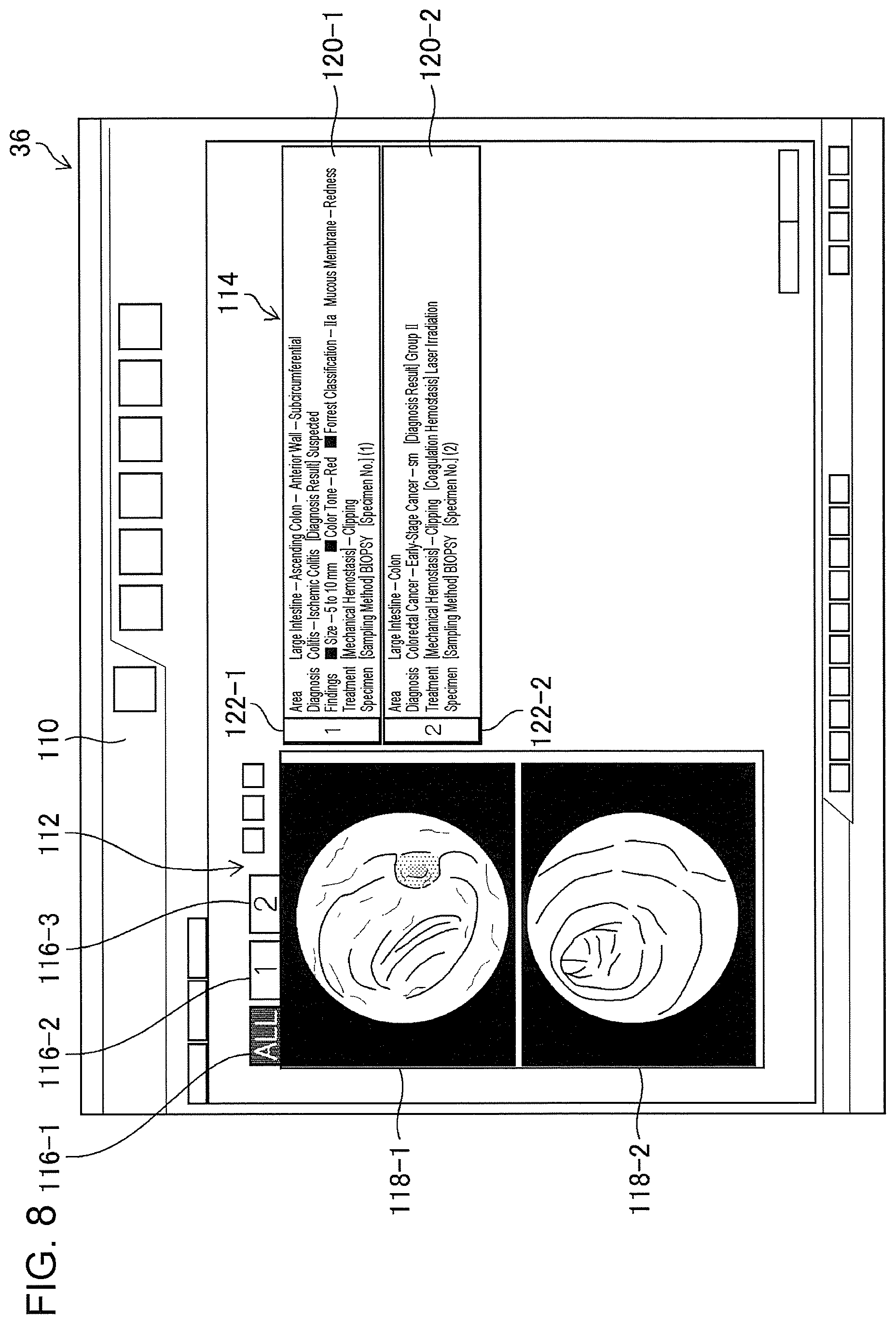 Patent US11776692 Figure 6 – Training data collection apparatus, training data collection method, program, training system, trained model, and endoscopic image processing apparatus