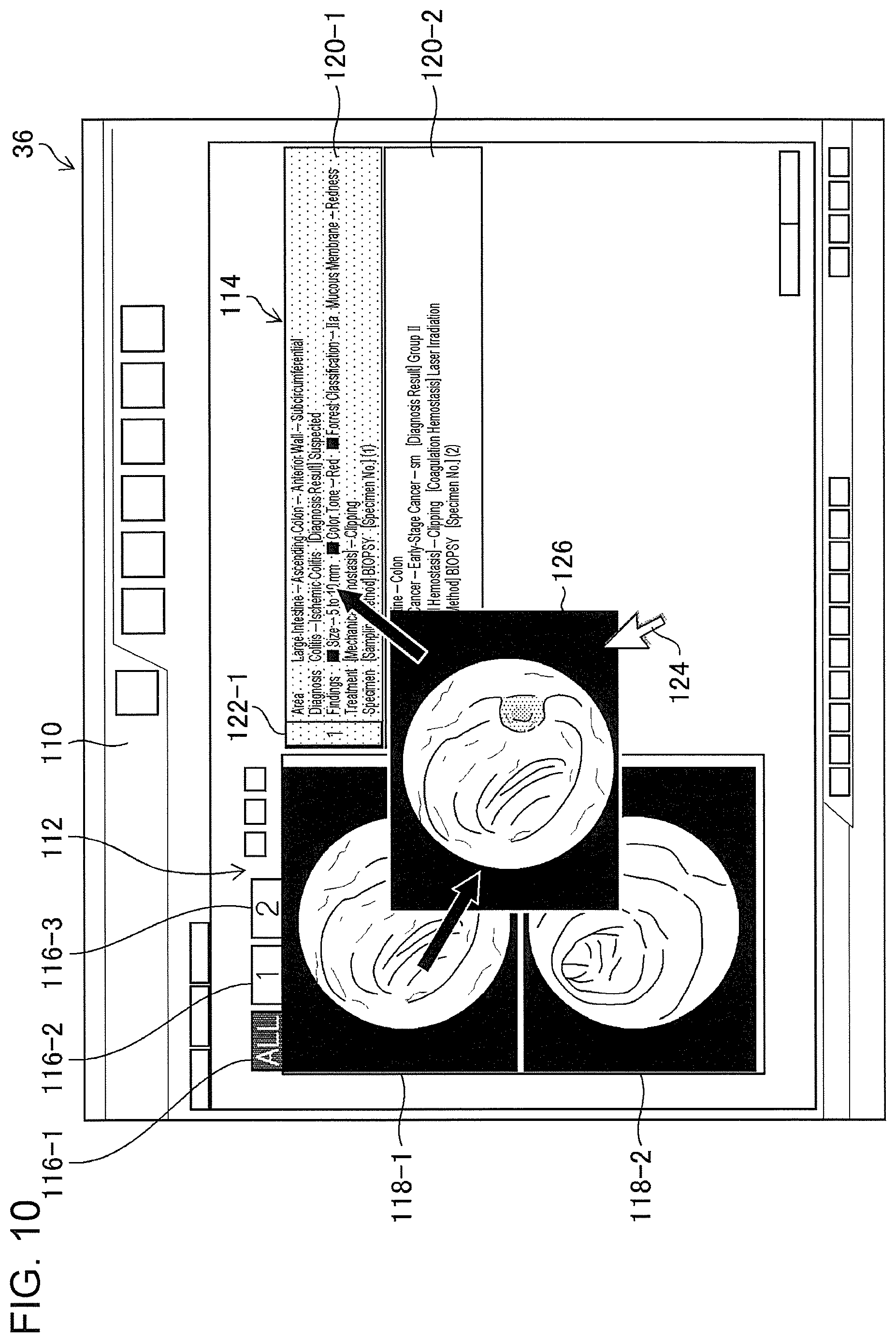 Patent US11776692 Figure 8 – Training data collection apparatus, training data collection method, program, training system, trained model, and endoscopic image processing apparatus