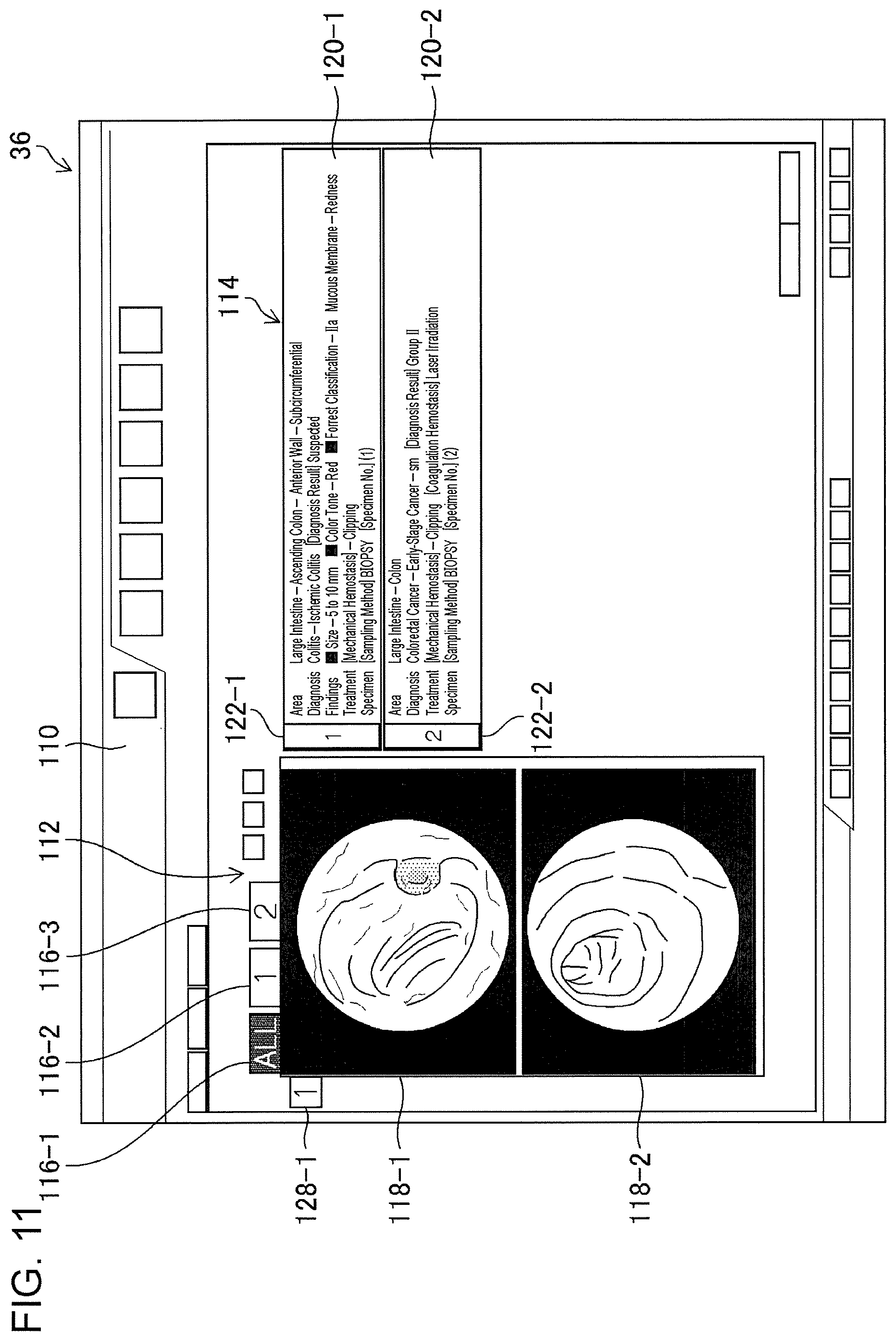 Patent US11776692 Figure 9 – Training data collection apparatus, training data collection method, program, training system, trained model, and endoscopic image processing apparatus