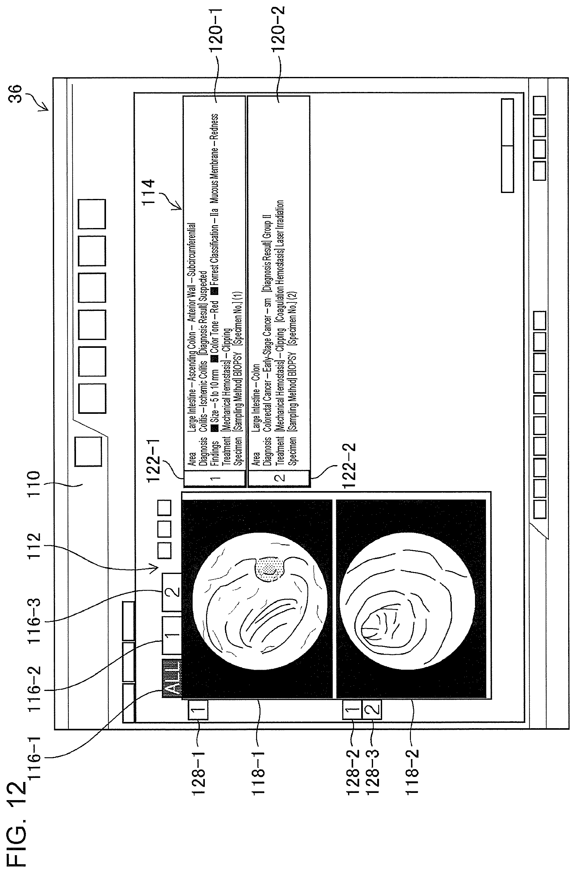 Patent US11776692 Figure 10 – Training data collection apparatus, training data collection method, program, training system, trained model, and endoscopic image processing apparatus