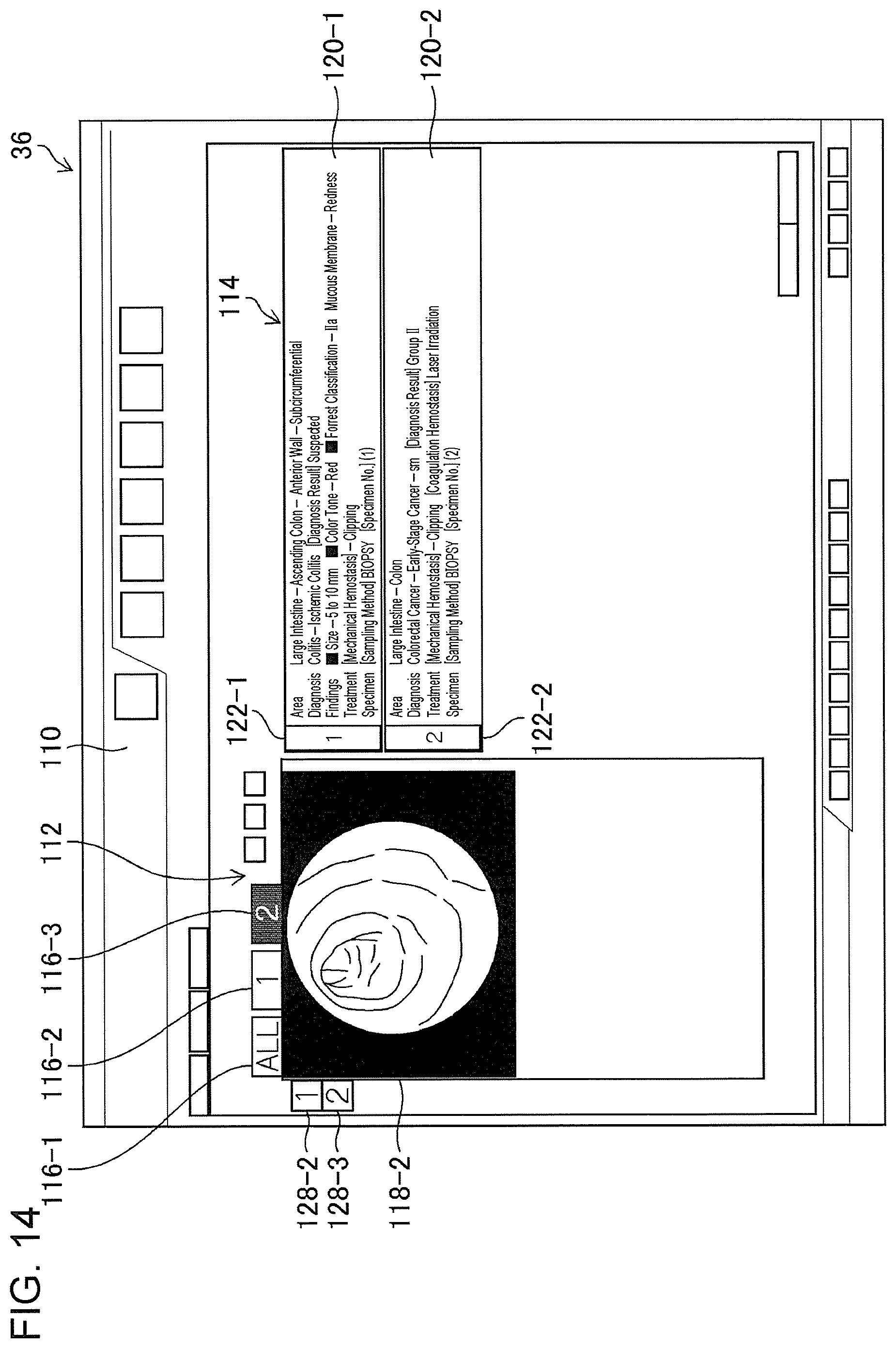 Patent US11776692 Figure 12 – Training data collection apparatus, training data collection method, program, training system, trained model, and endoscopic image processing apparatus