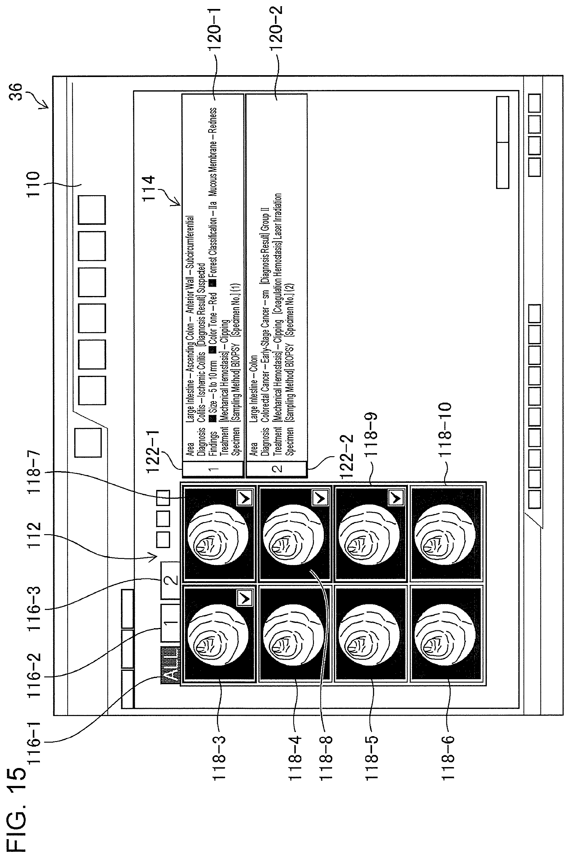 Patent US11776692 Figure 13 – Training data collection apparatus, training data collection method, program, training system, trained model, and endoscopic image processing apparatus