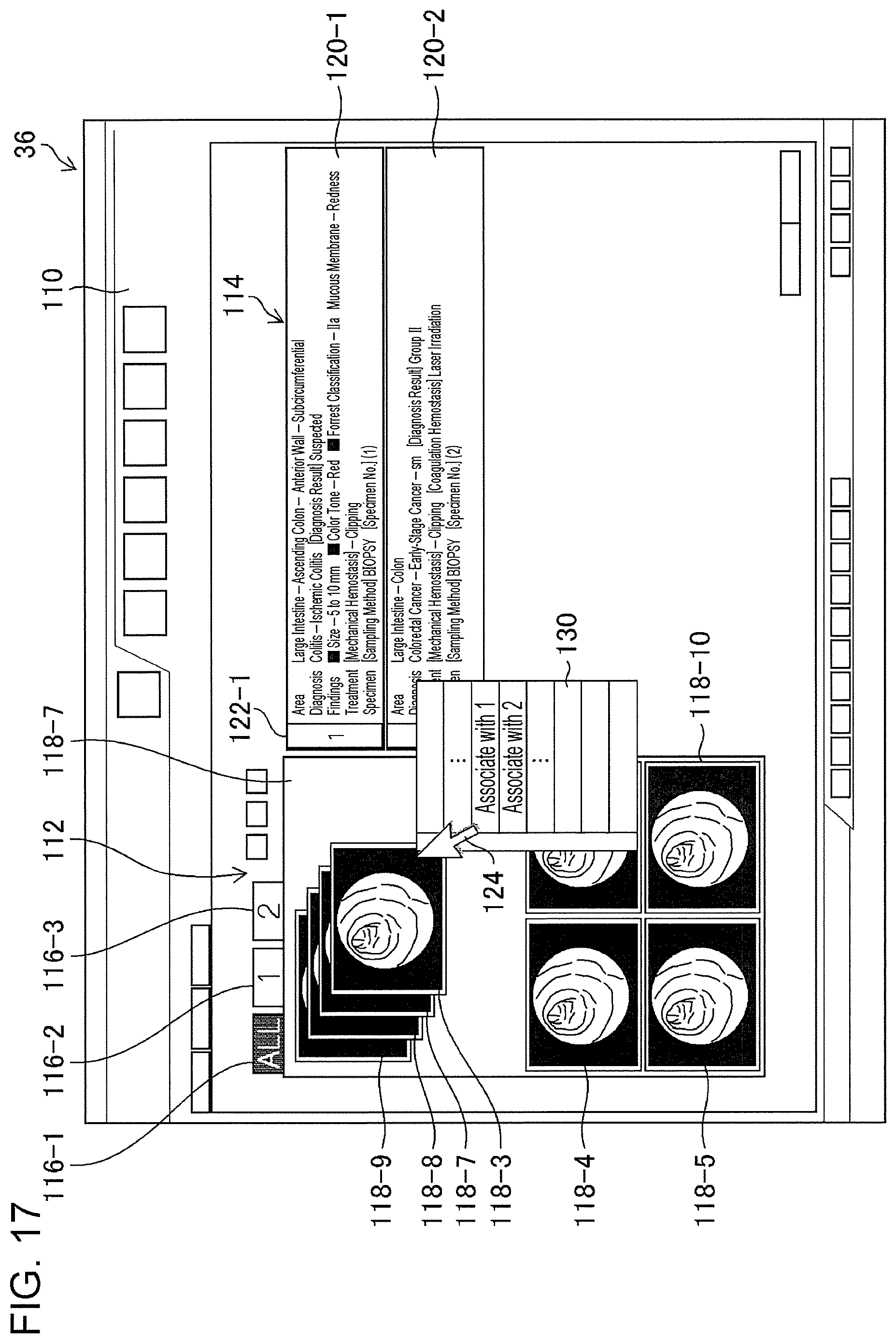 Patent US11776692 Figure 15 – Training data collection apparatus, training data collection method, program, training system, trained model, and endoscopic image processing apparatus