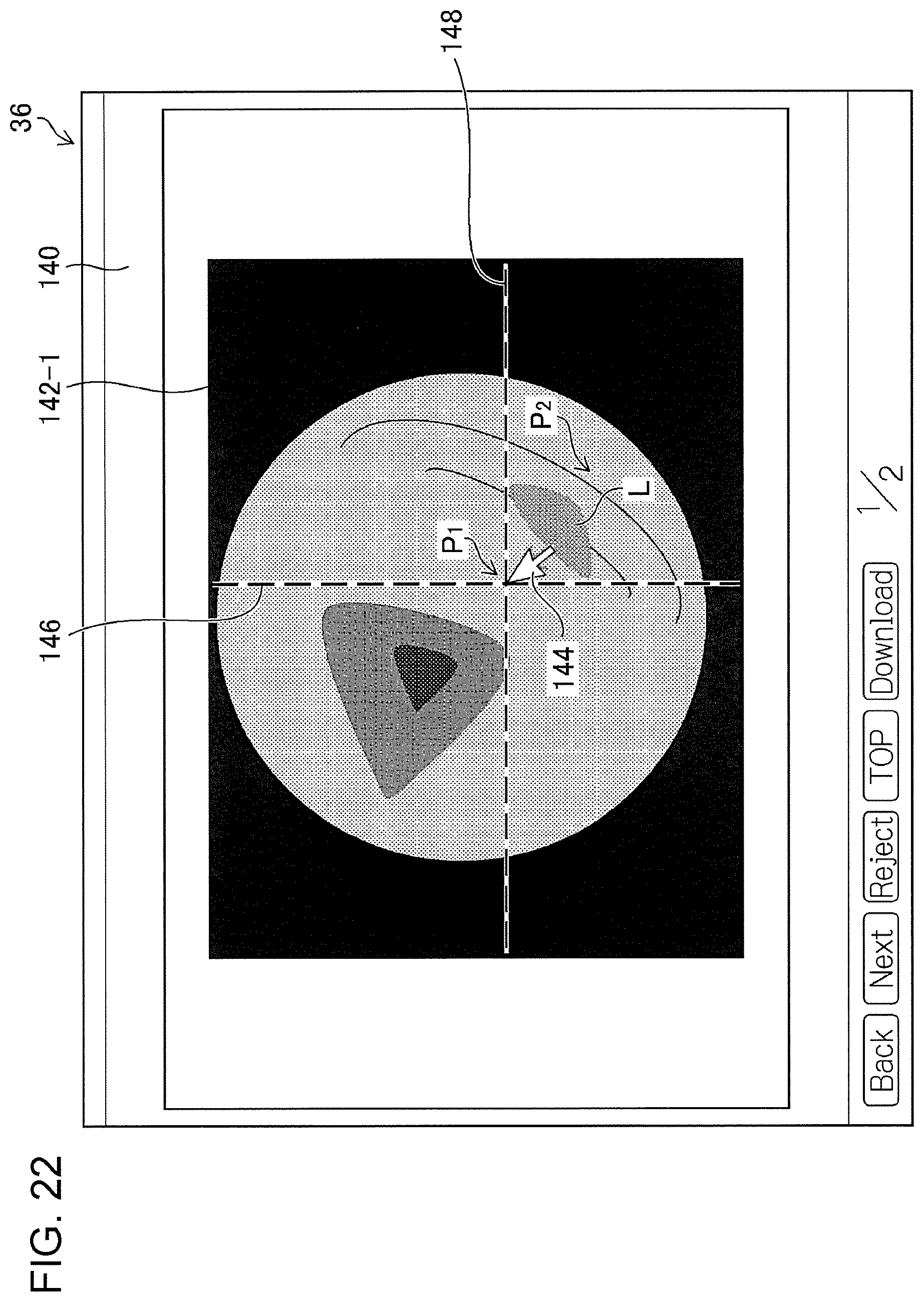 Patent US11776692 Figure 19 – Training data collection apparatus, training data collection method, program, training system, trained model, and endoscopic image processing apparatus
