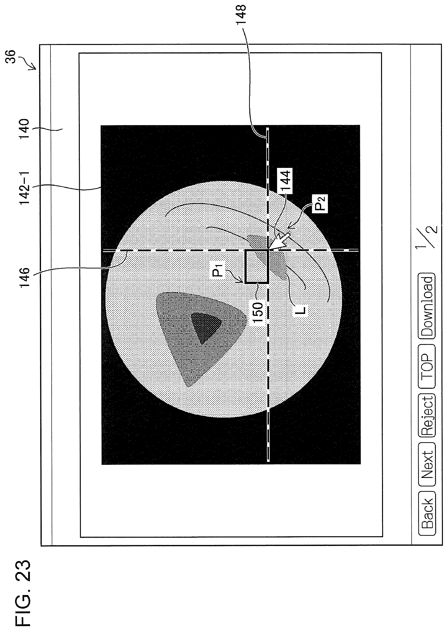 Patent US11776692 Figure 20 – Training data collection apparatus, training data collection method, program, training system, trained model, and endoscopic image processing apparatus