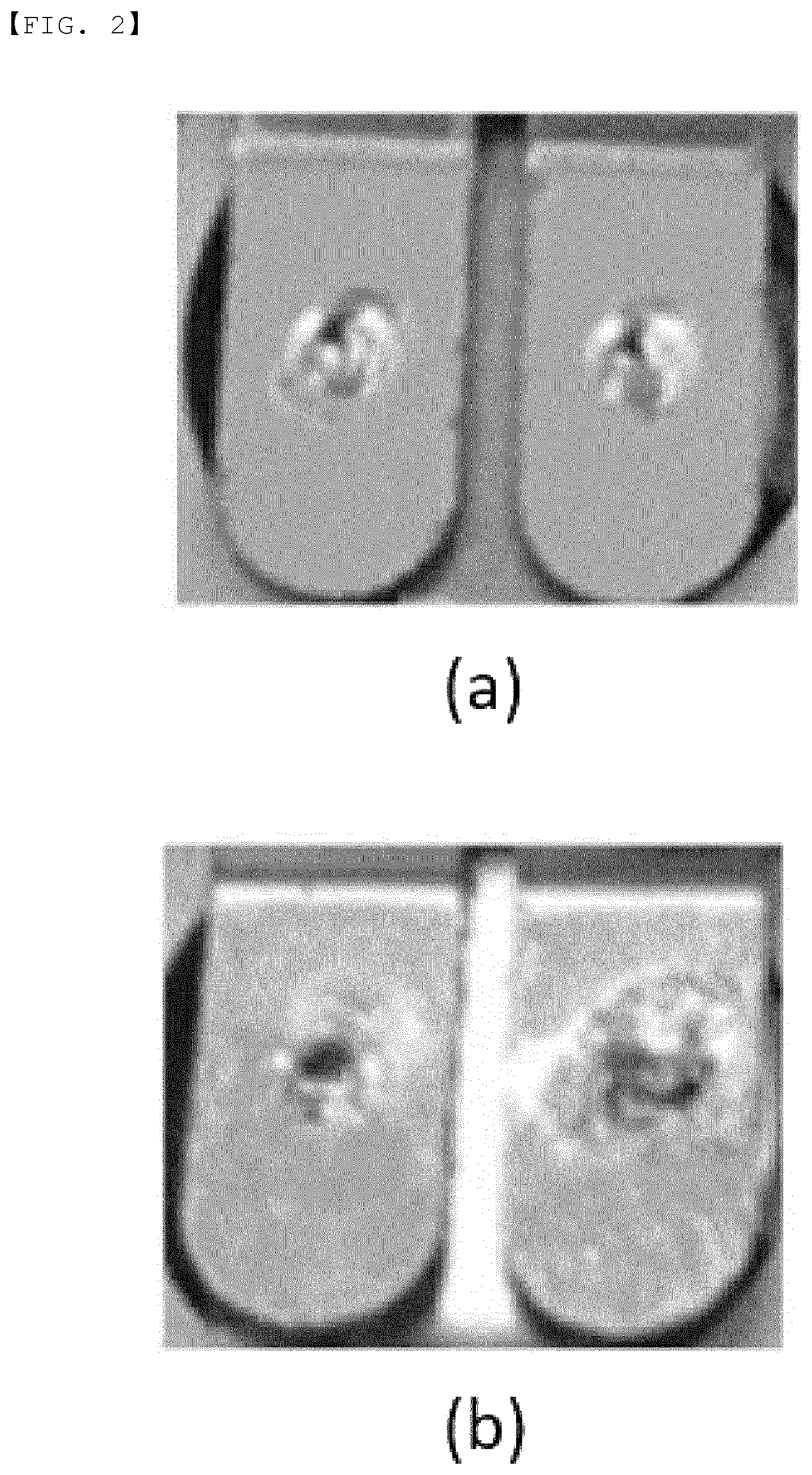 Patent US11777181 Figure 2 – Metal plate for resistance welding and resistance welding method using the same