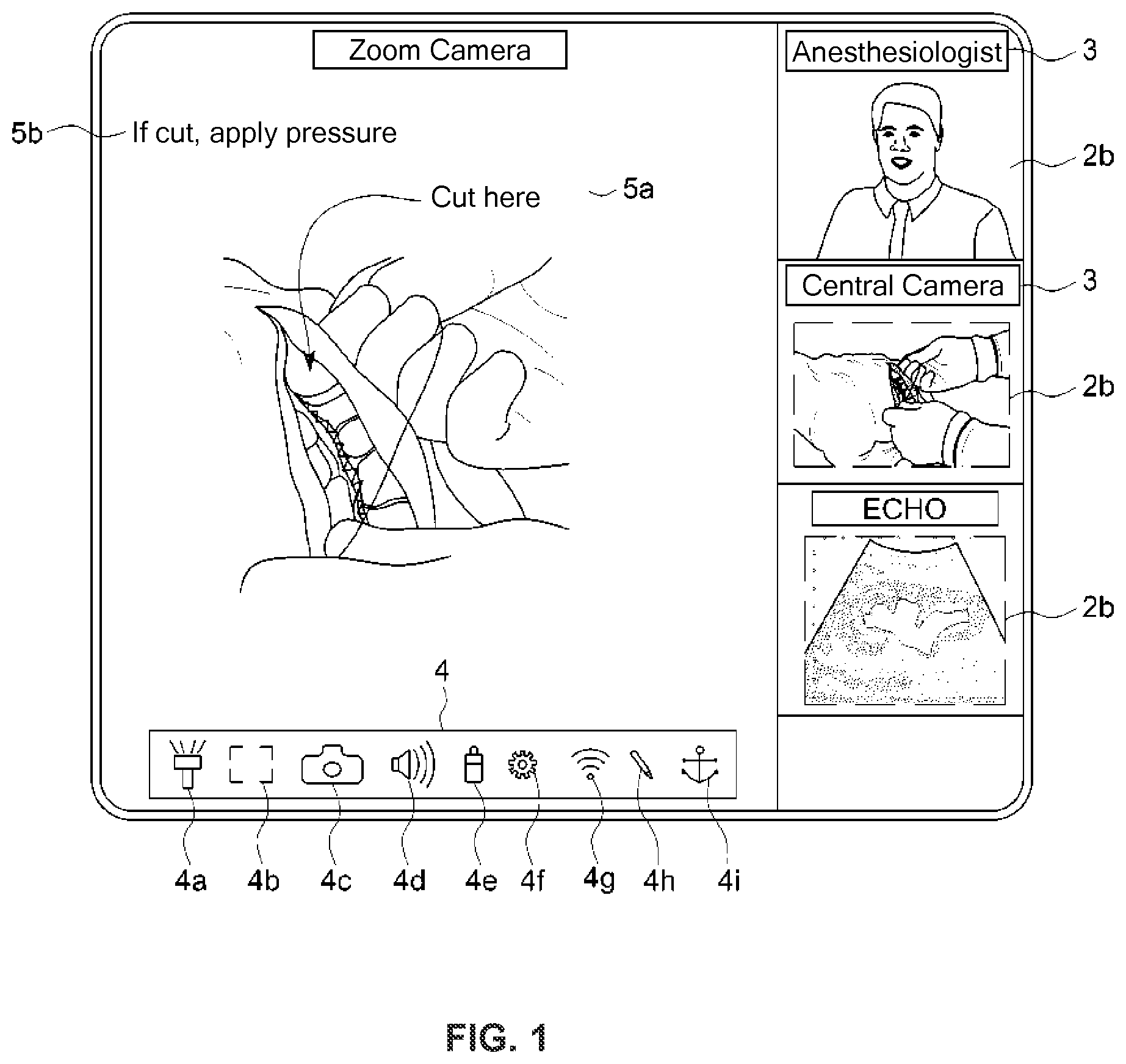 Patent US11778141 Figure 1 – Contactless configuration of a videoconference in sterile environments
