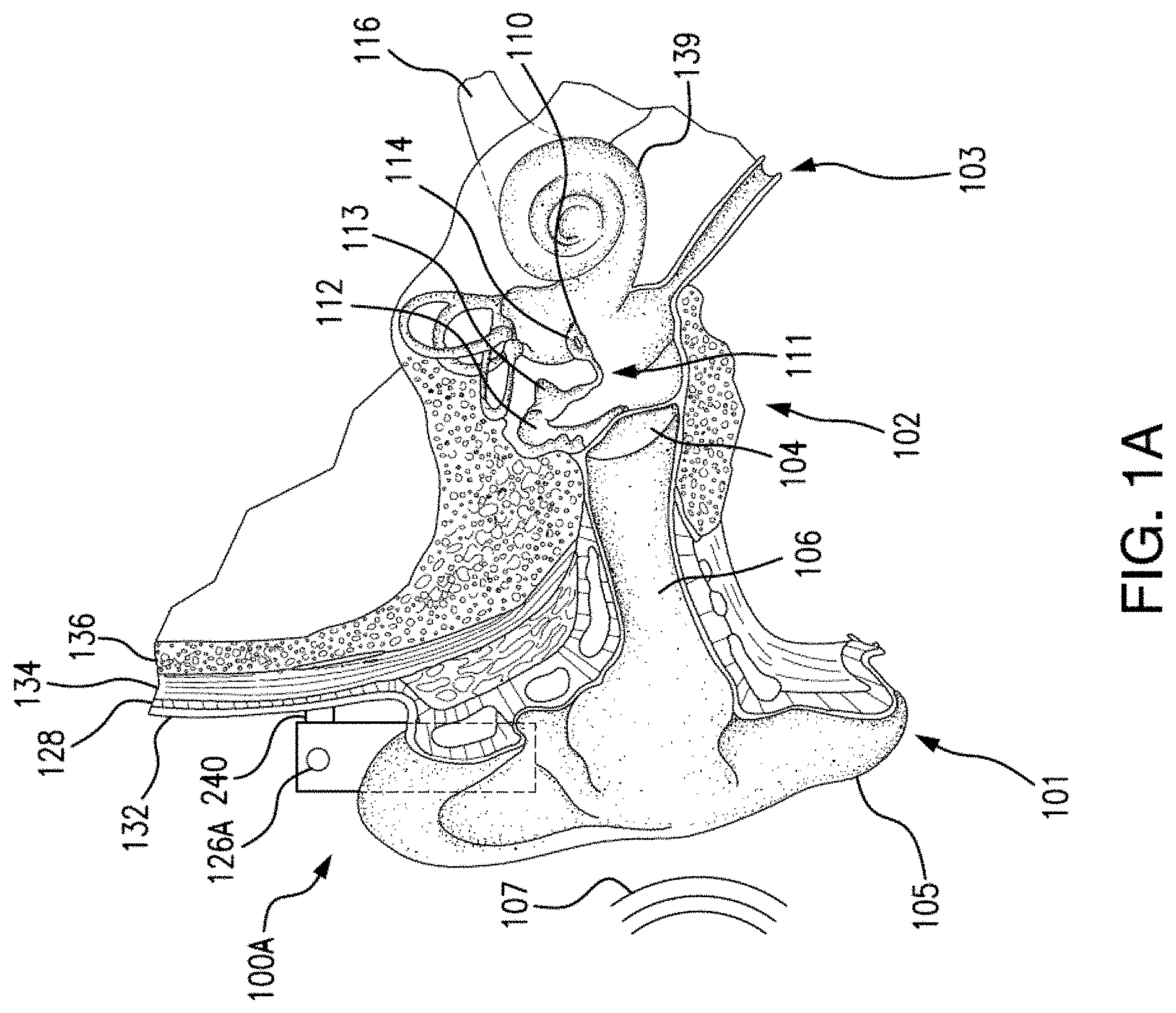 Patent US11778385 Figure 1 – Electromagnetic transducer with non-axial air gap