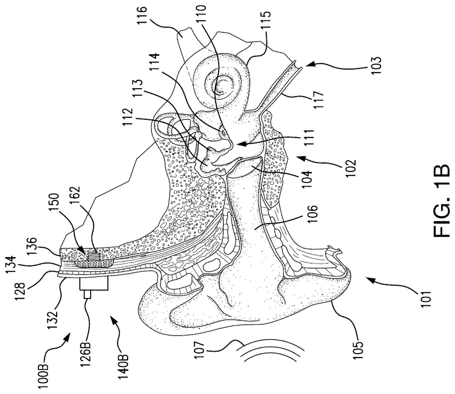 Patent US11778385 Figure 2 – Electromagnetic transducer with non-axial air gap