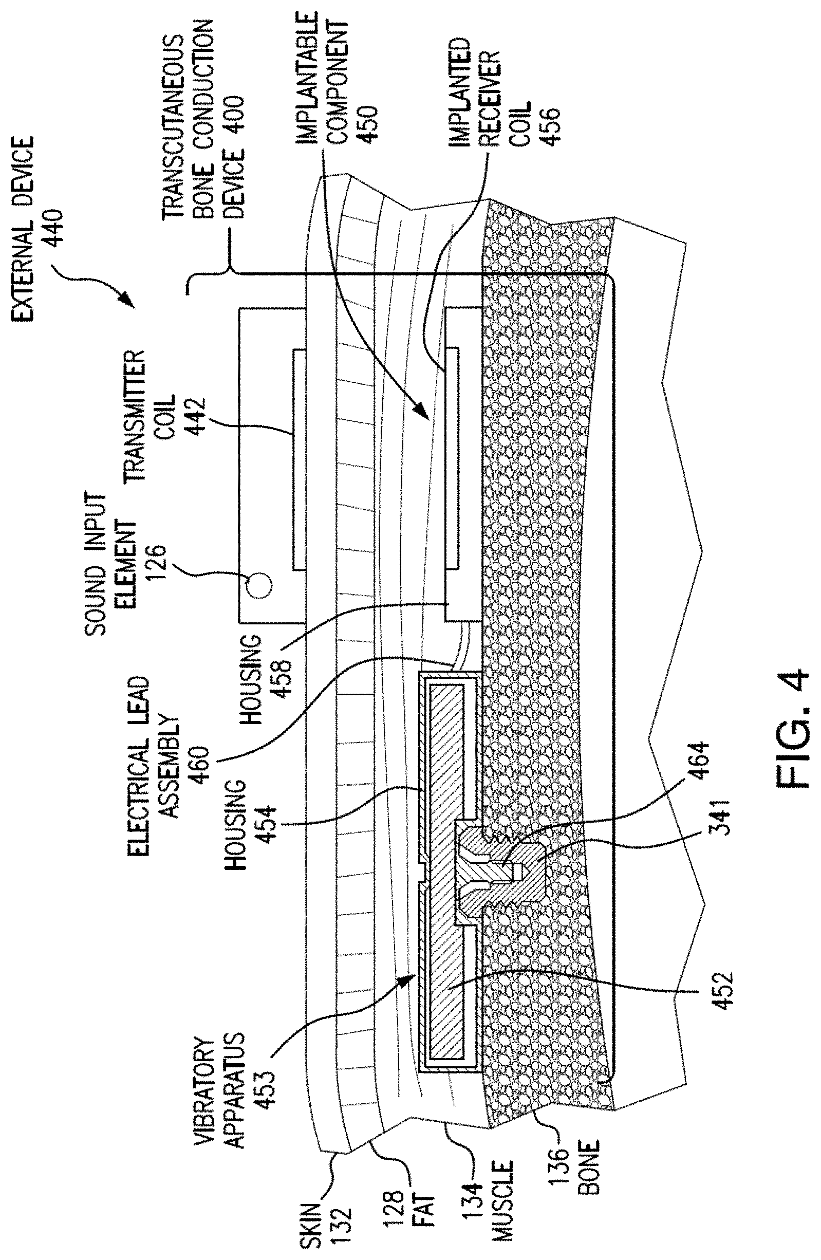 Patent US11778385 Figure 5 – Electromagnetic transducer with non-axial air gap