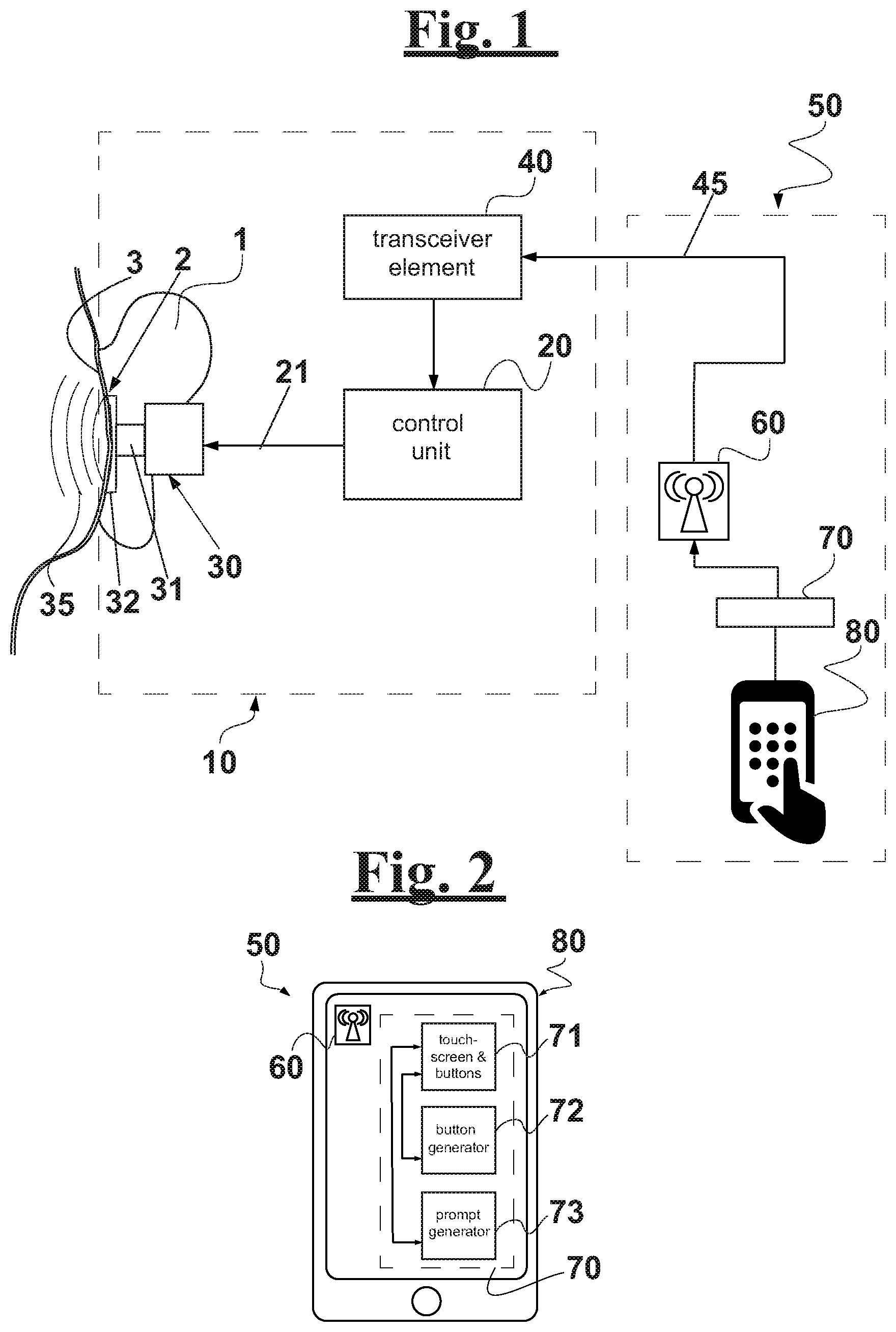 Patent US11778396 Figure 1 – Electromechanical stimulation system for treating tinnitus