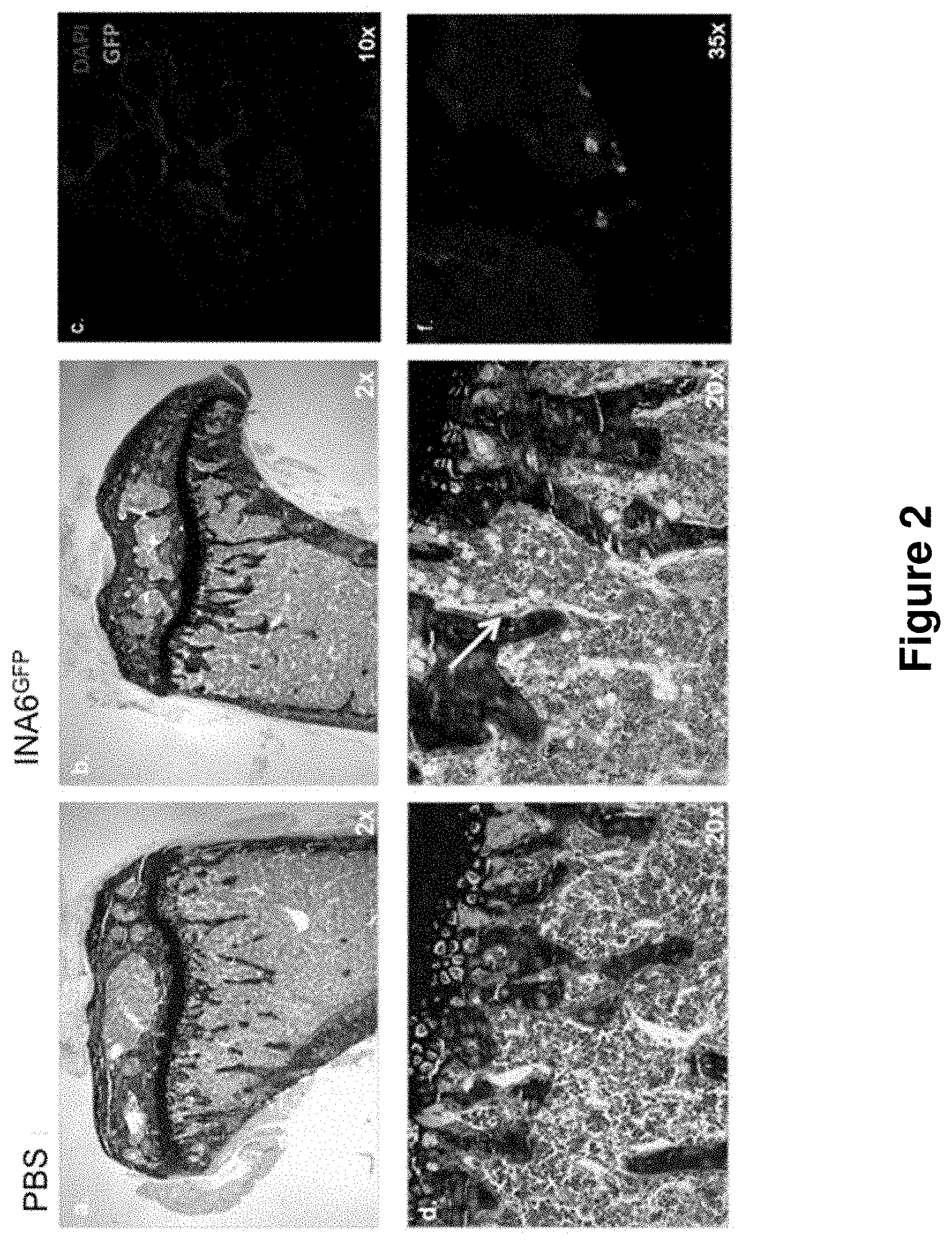 Patent US11778995 Figure 2 – Genetically modified non-human animals and methods of use thereof