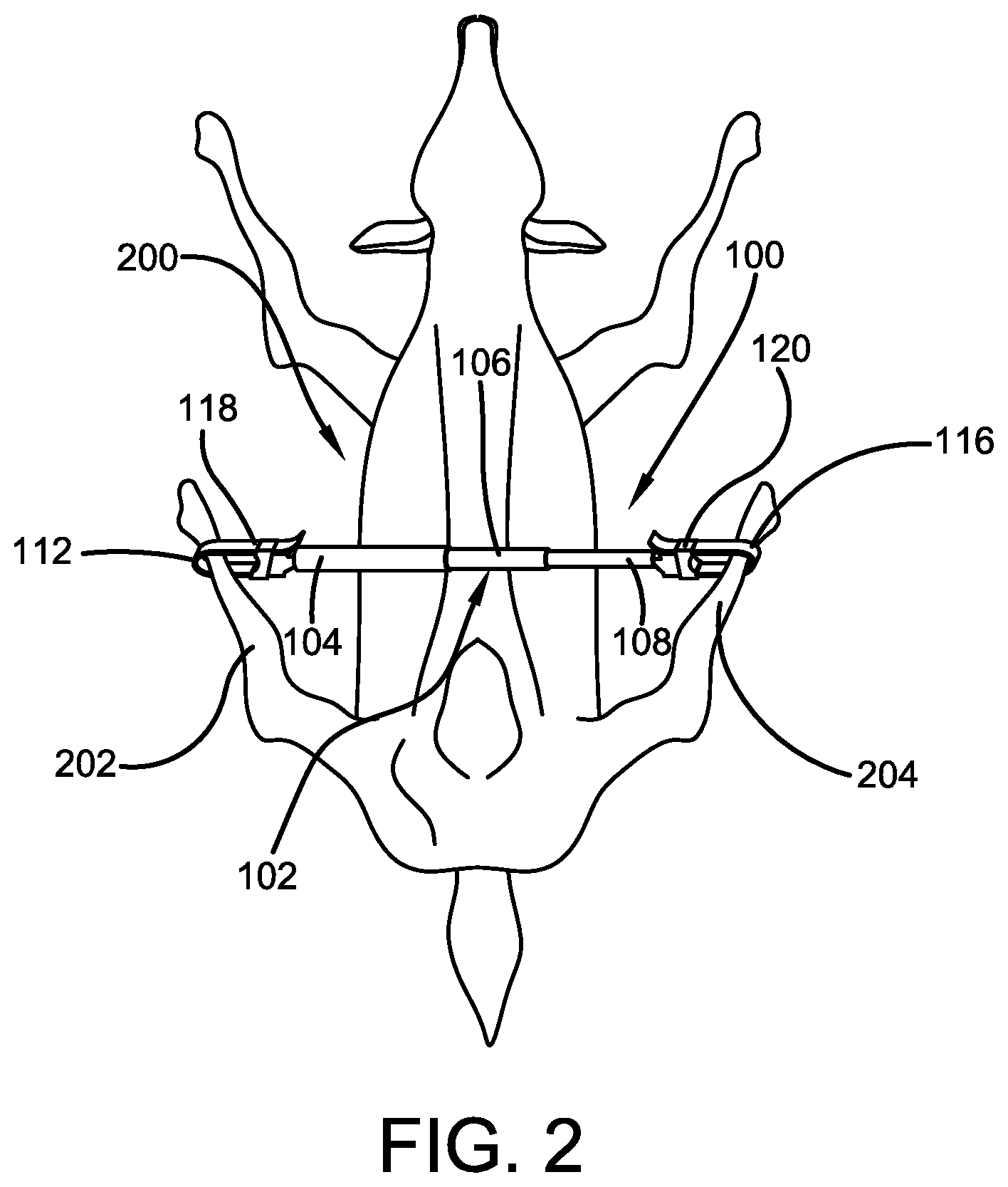 Patent US11779008 Figure 2 – Game animal field dressing device