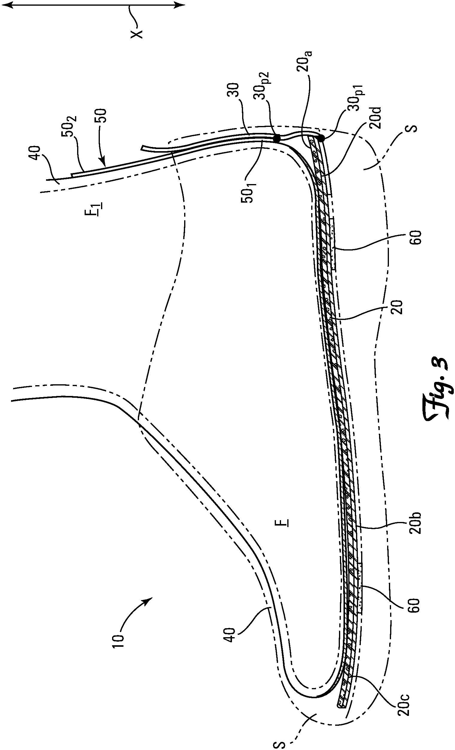 Patent US11779058 Figure 3 – Footwear system with restricted ambulation hindfoot longitudinal slide