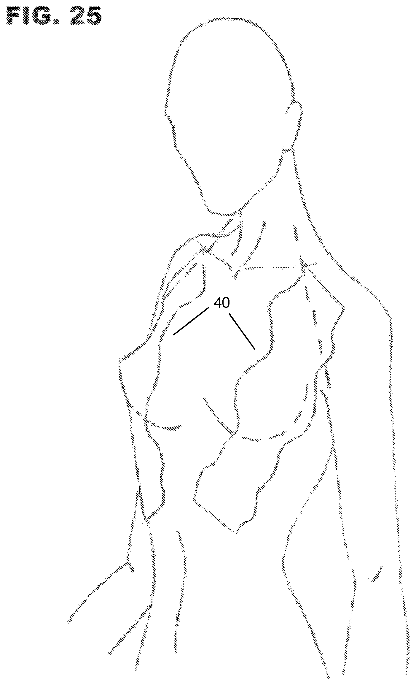 Patent US11779061 Figure 15 – Dynamic function fashion tape and methodology