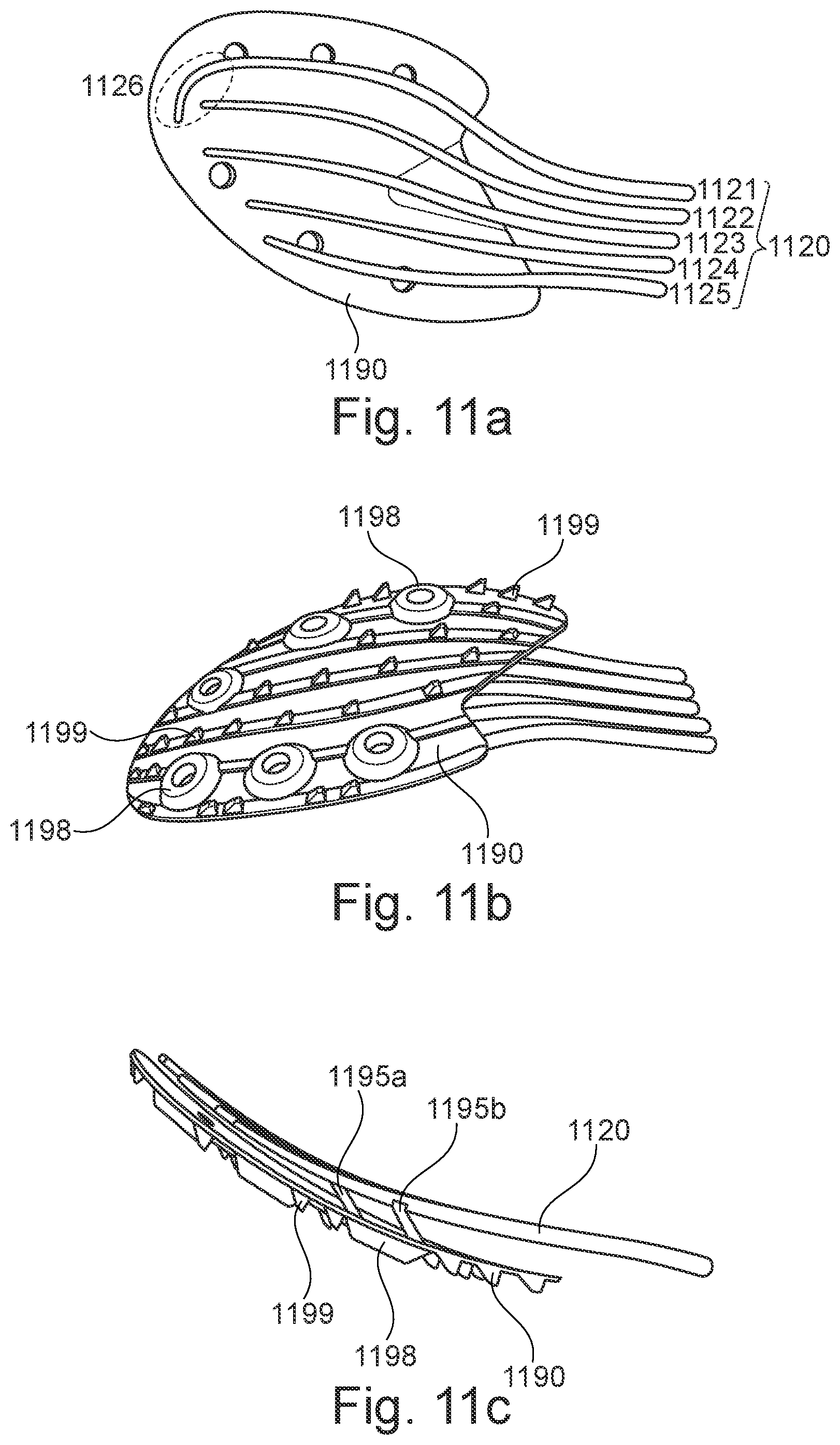 Patent US11779077 Figure 18 – Sole comprising individually deflectable reinforcing members, shoe with such a sole, and method for the manufacture of such items
