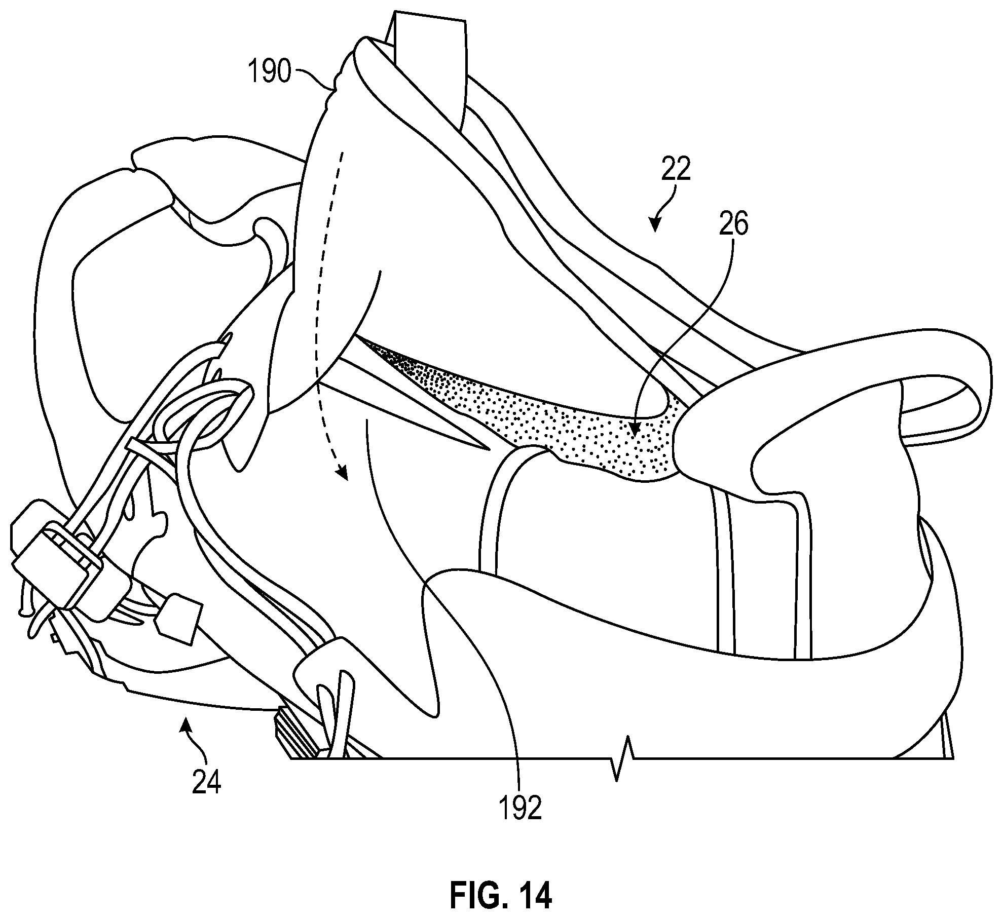Patent US11779078 Figure 15 – Article of footwear with zonal cushioning system