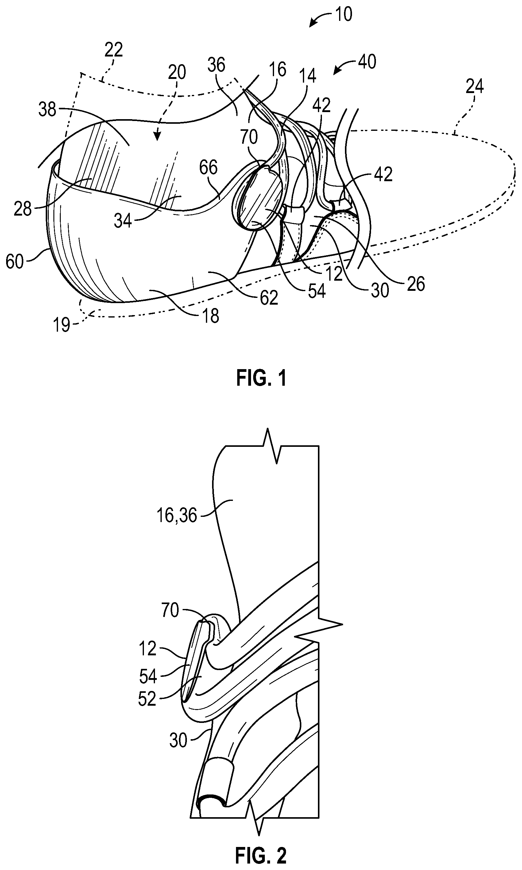 Patent US11779082 Figure 1 – Lace guide for an article of footwear