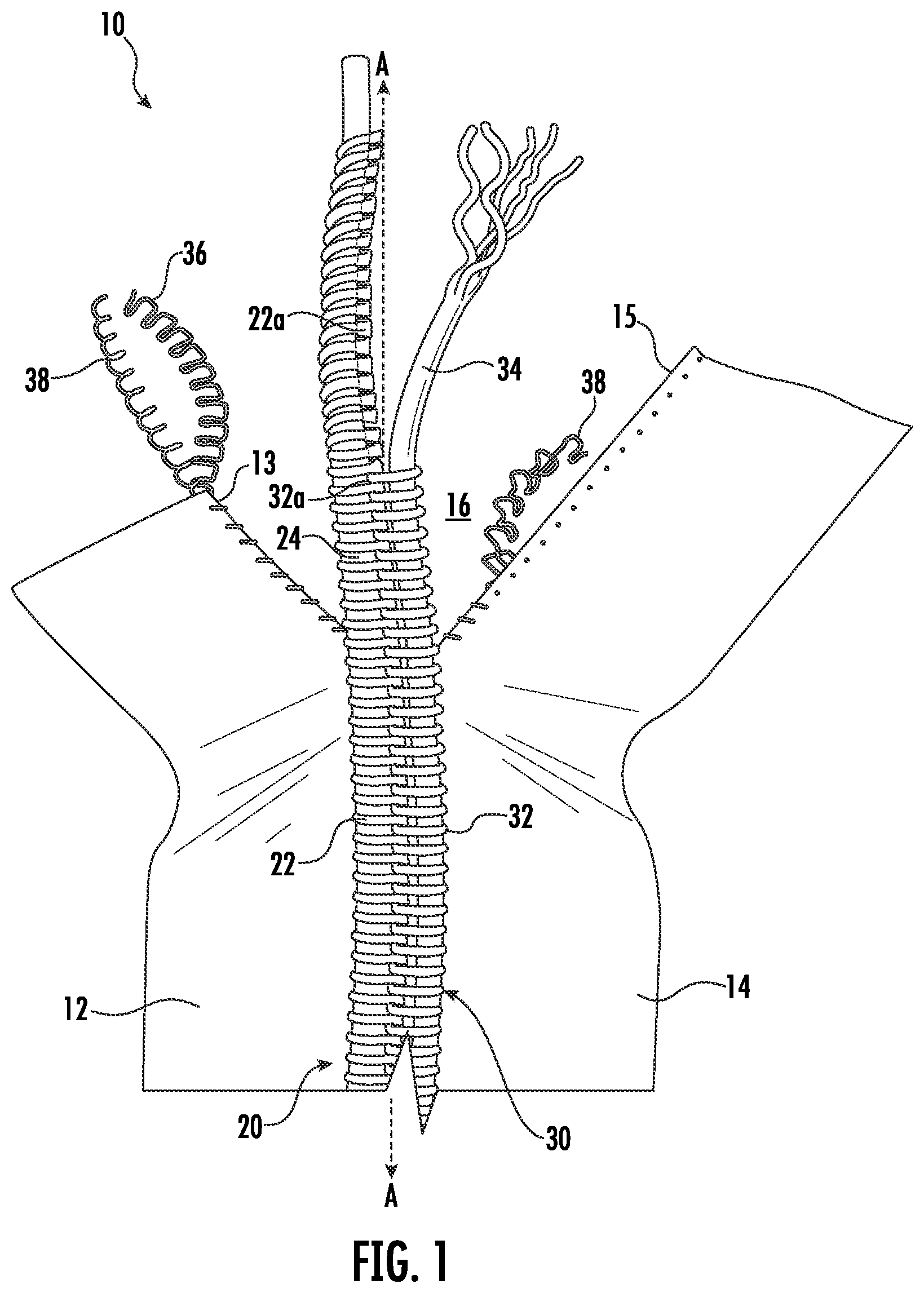Patent US11779086 Figure 1 – Flame and heat-resistant fastener chain and methods of manufacturing the same