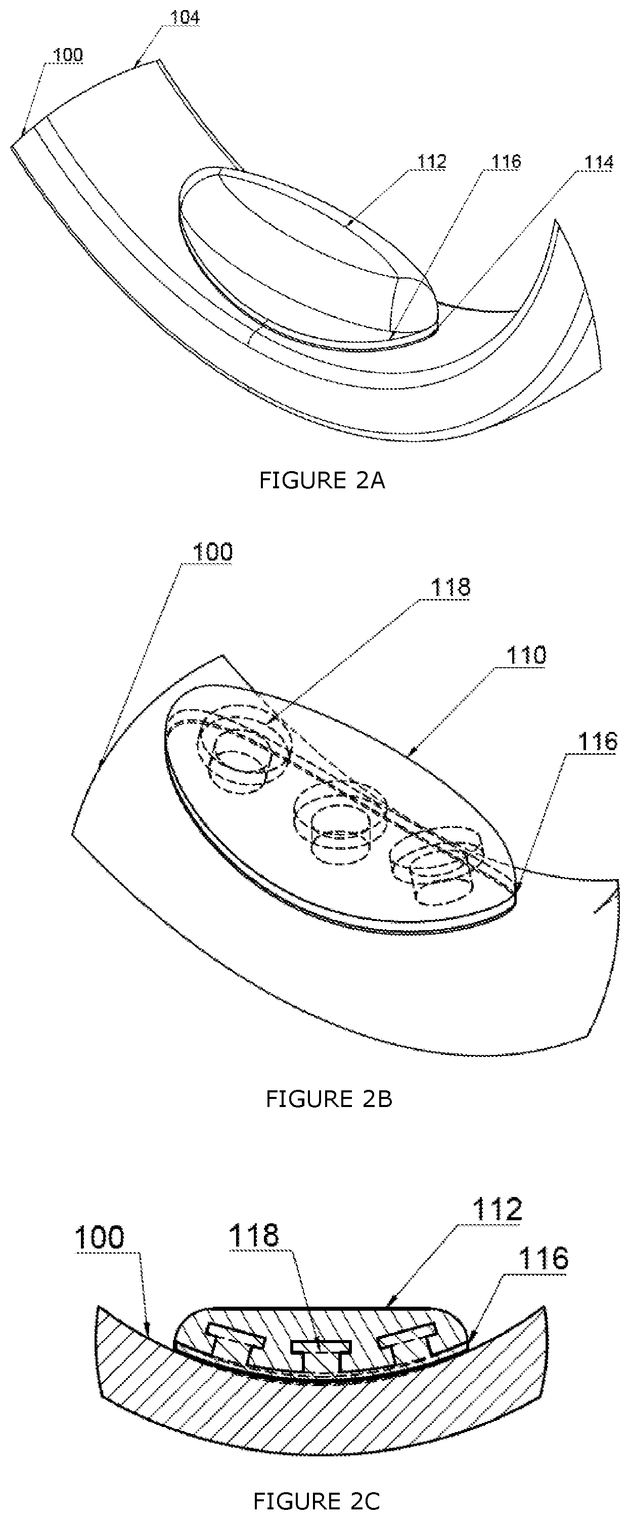 Patent US11779088 Figure 2 – Pad for tightening a ring upon a finger, and methods and kit relating thereto