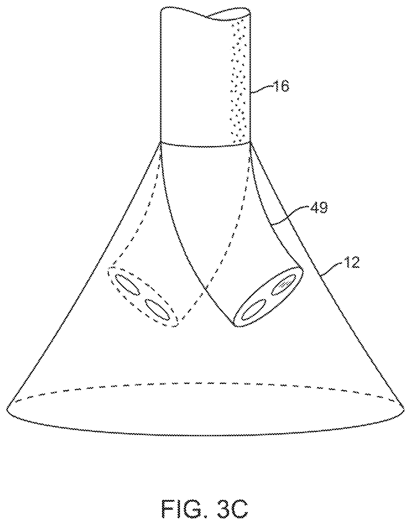 Patent US11779195 Figure 6 – Precision control systems for tissue visualization and manipulation assemblies