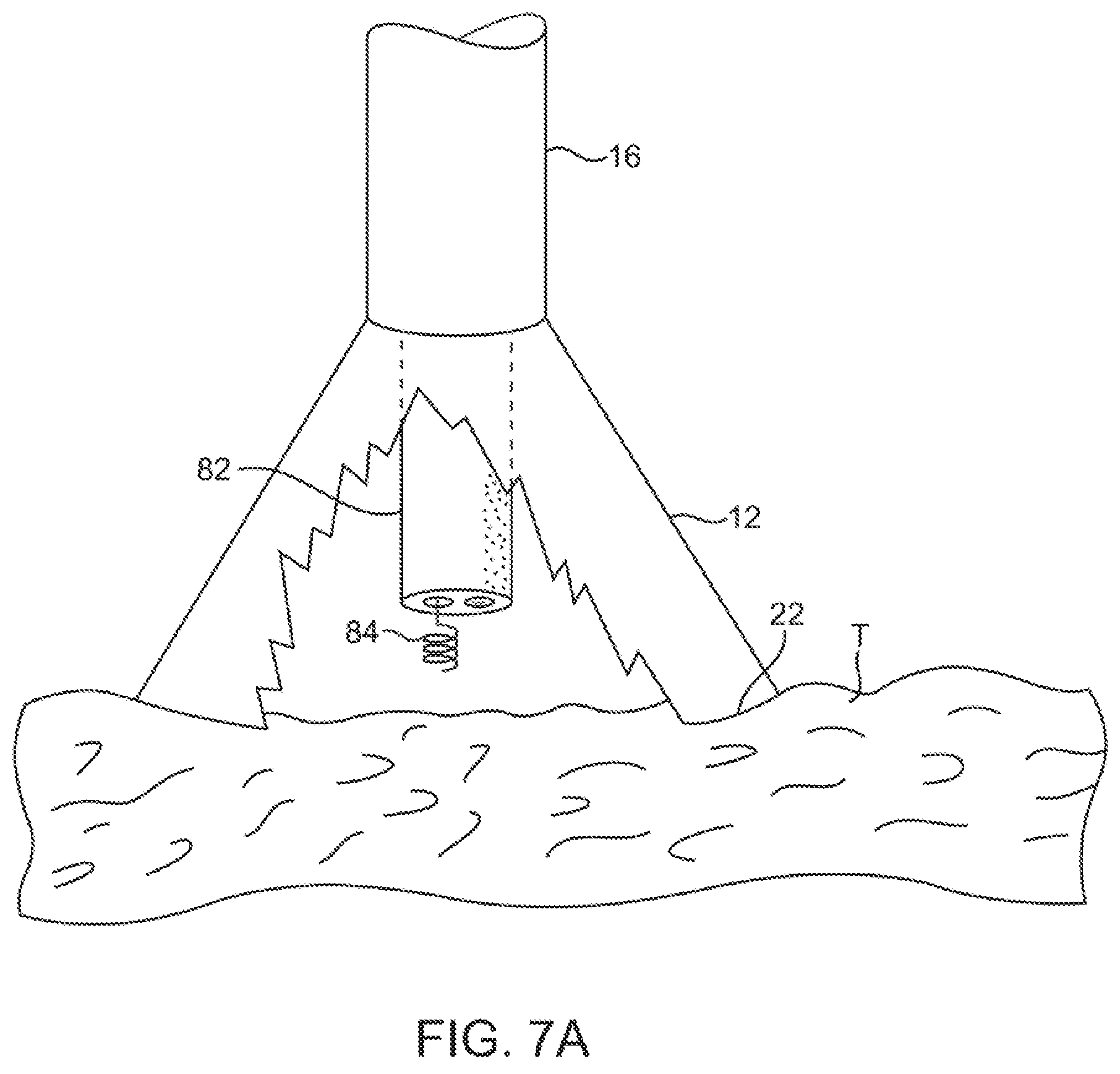 Patent US11779195 Figure 9 – Precision control systems for tissue visualization and manipulation assemblies