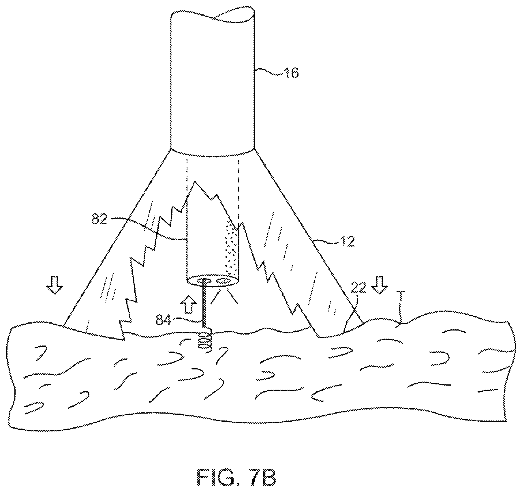 Patent US11779195 Figure 10 – Precision control systems for tissue visualization and manipulation assemblies