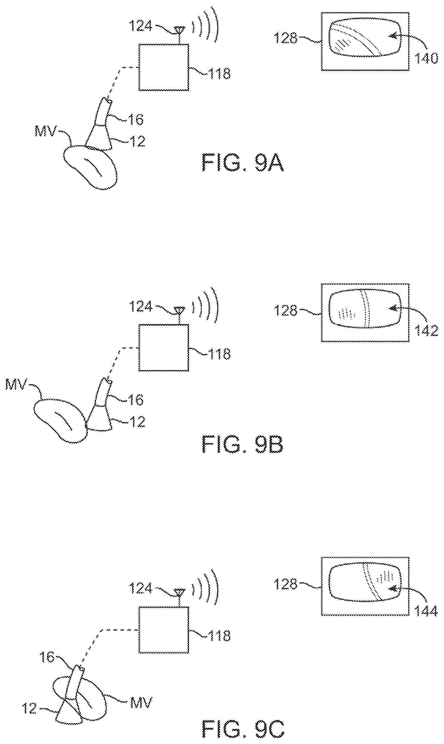Patent US11779195 Figure 14 – Precision control systems for tissue visualization and manipulation assemblies