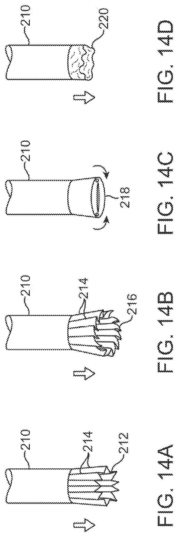 Patent US11779195 Figure 18 – Precision control systems for tissue visualization and manipulation assemblies