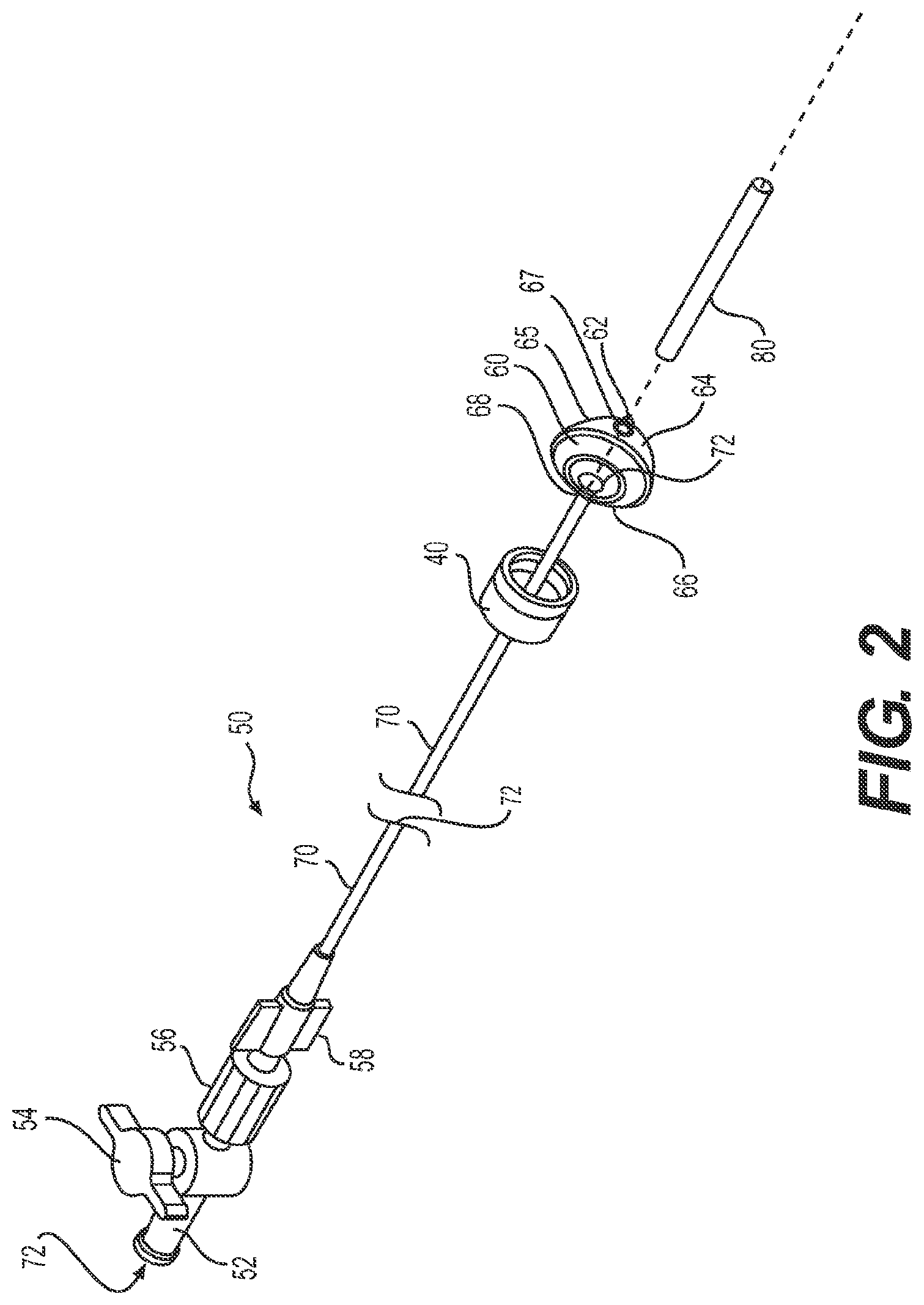Patent US11779196 Figure 2 – Gastrointestinal endoscopy with attachable intestine pleating structures