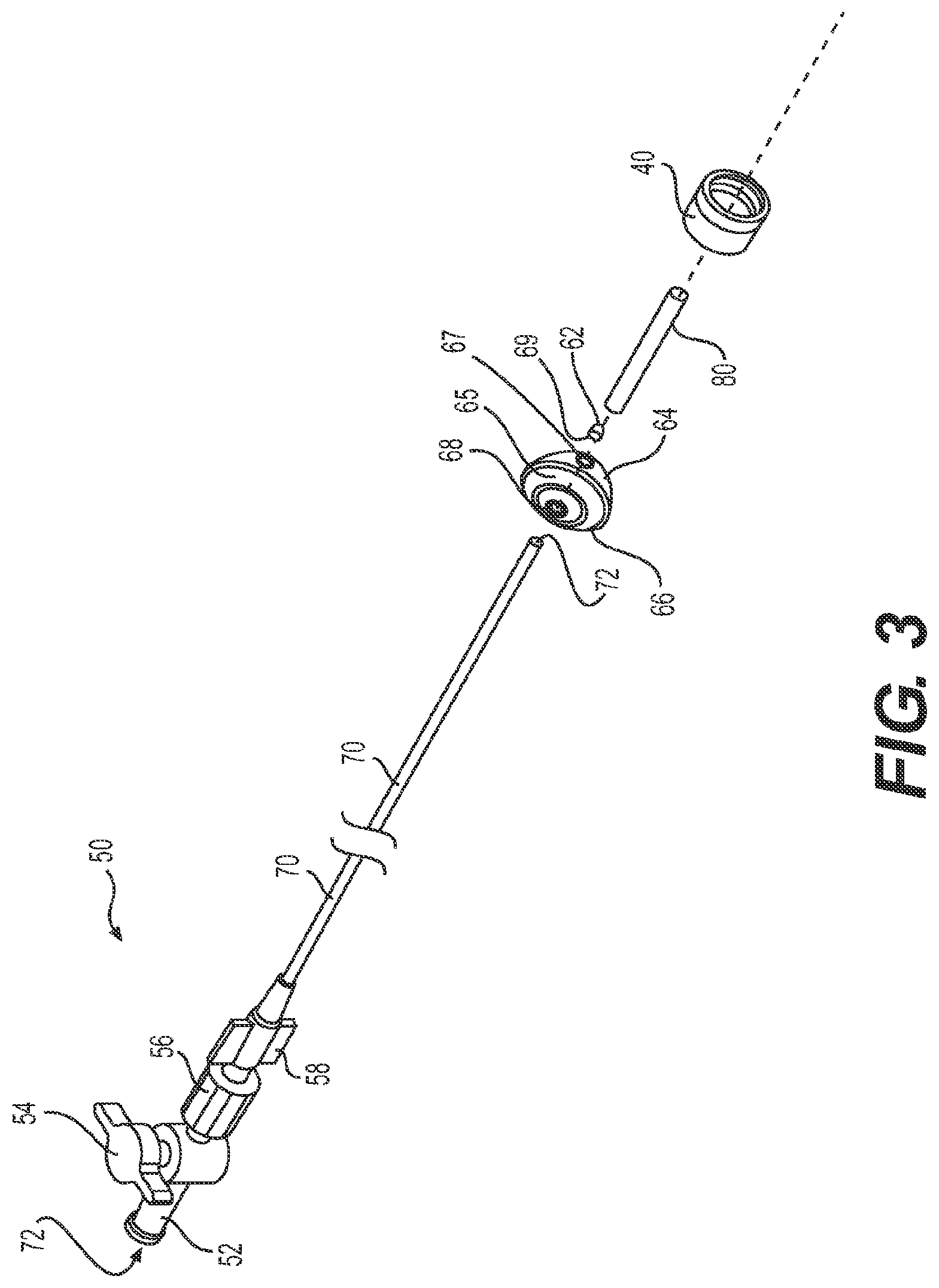 Patent US11779196 Figure 3 – Gastrointestinal endoscopy with attachable intestine pleating structures