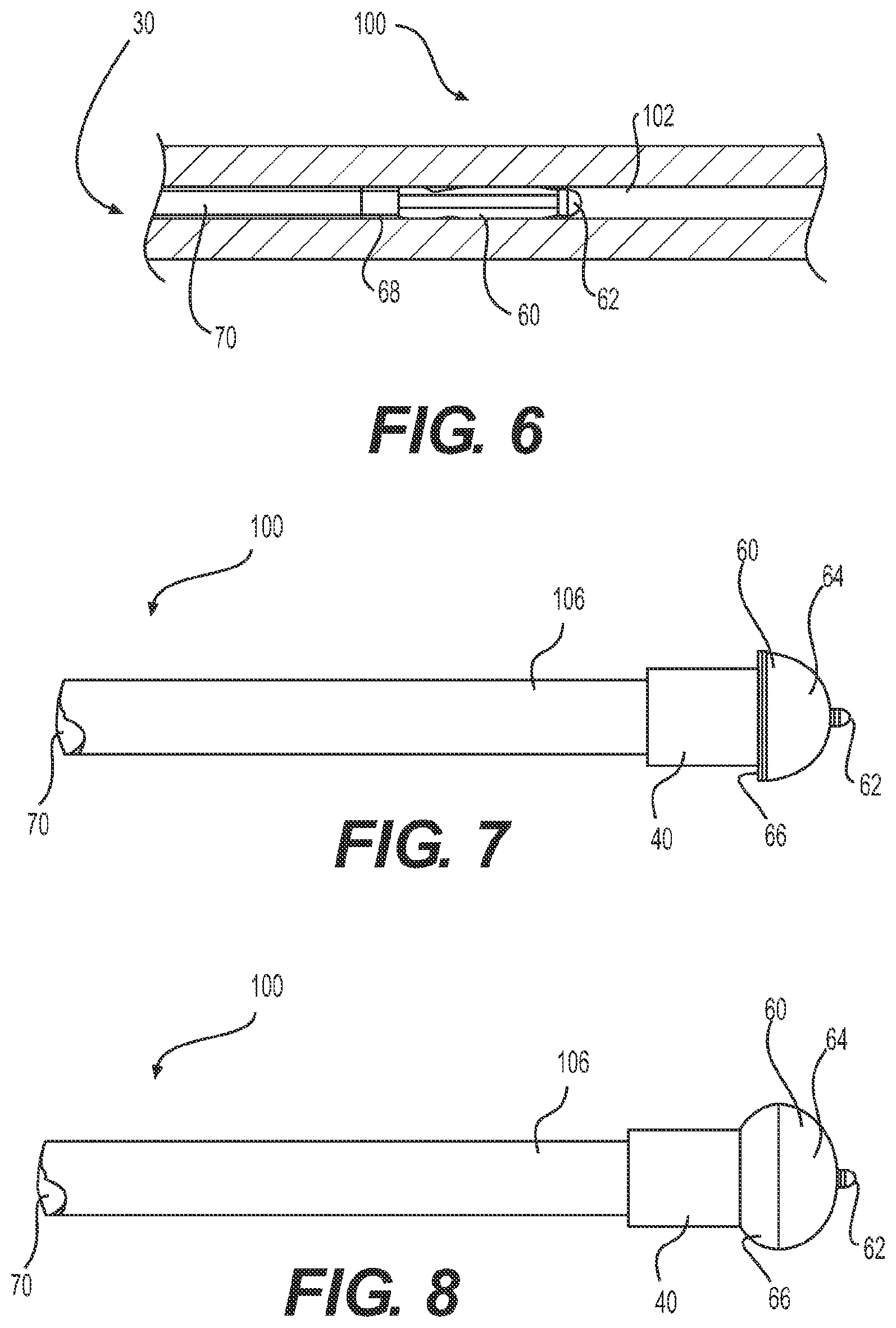 Patent US11779196 Figure 6 – Gastrointestinal endoscopy with attachable intestine pleating structures