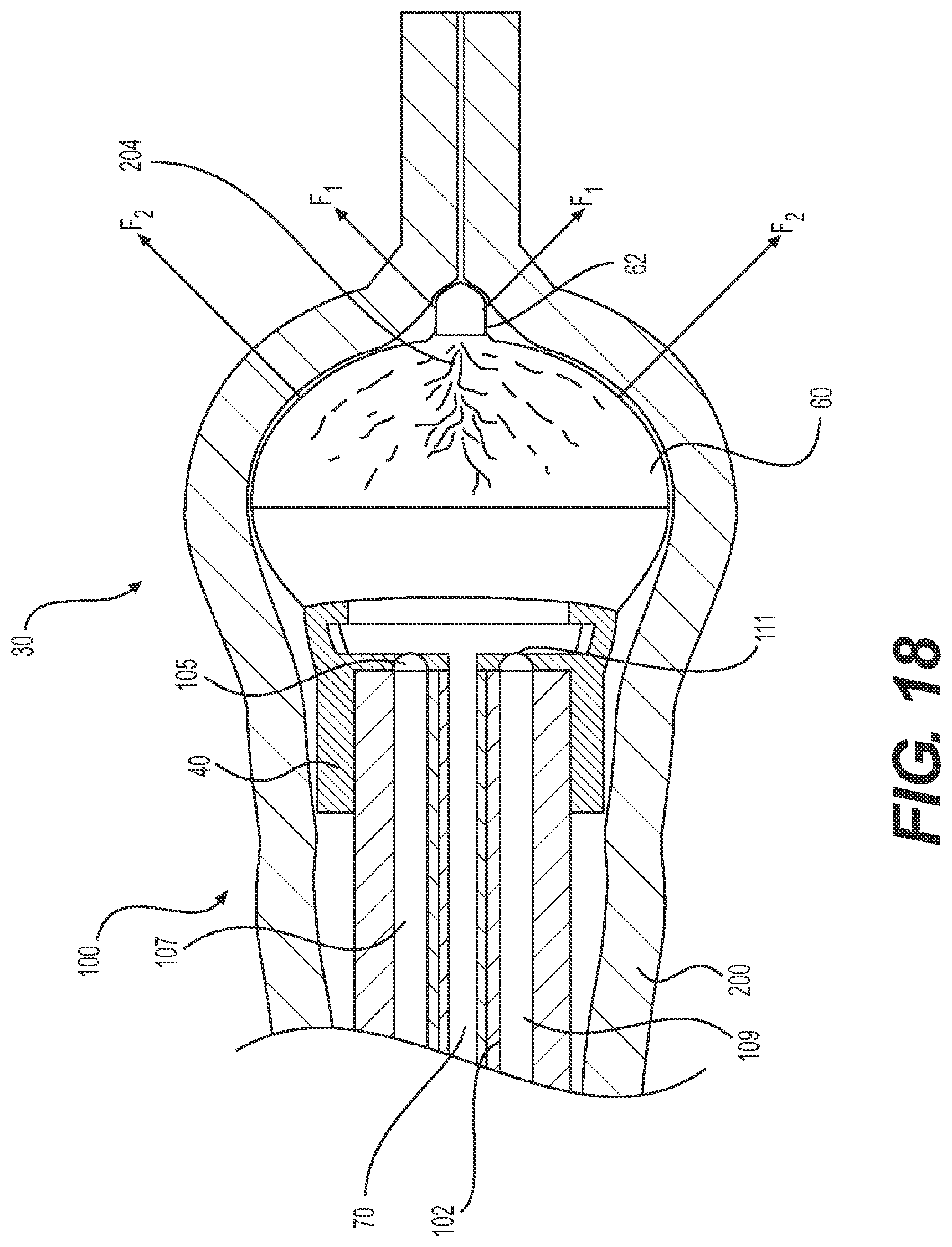 Patent US11779196 Figure 10 – Gastrointestinal endoscopy with attachable intestine pleating structures