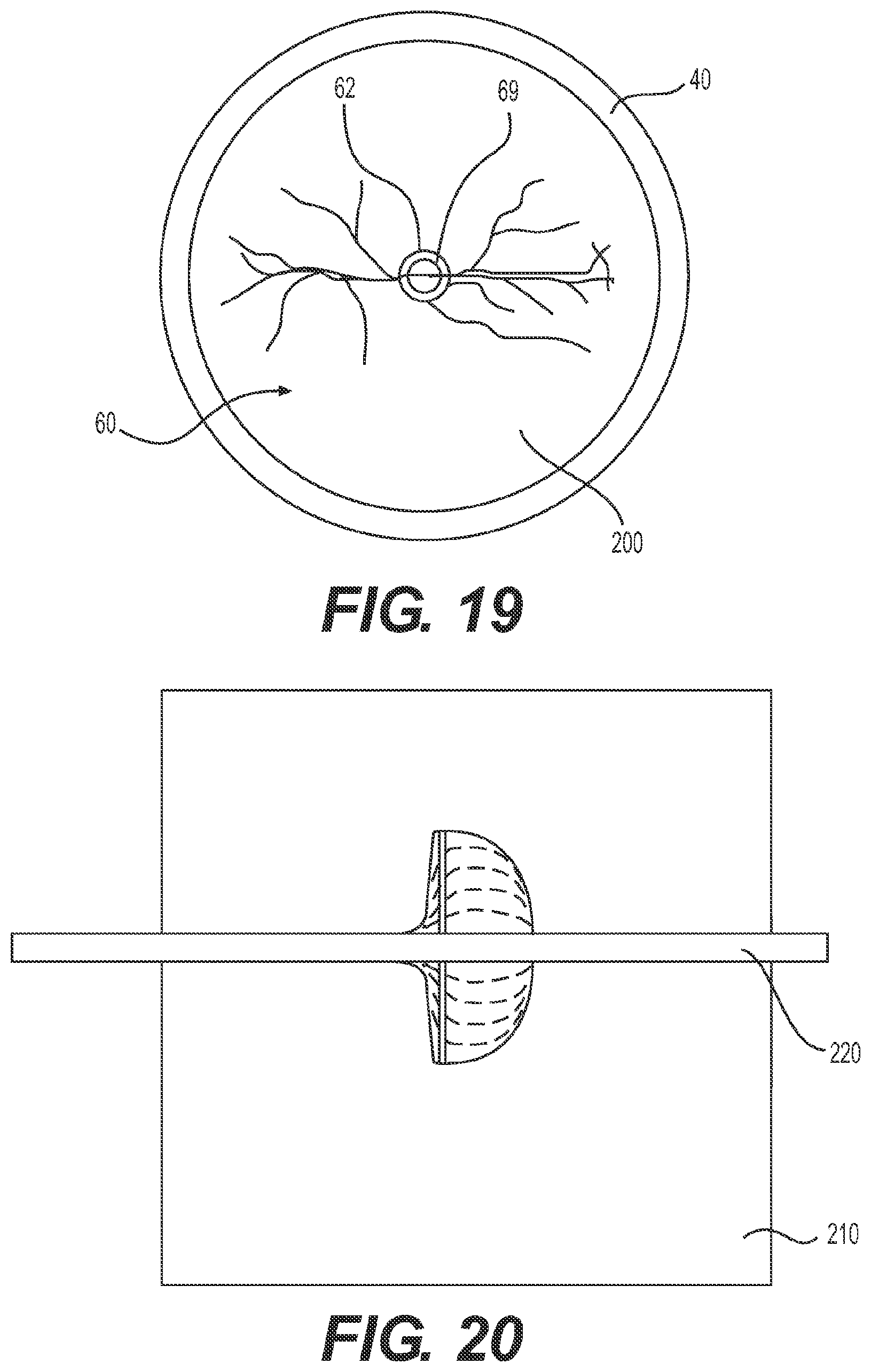 Patent US11779196 Figure 11 – Gastrointestinal endoscopy with attachable intestine pleating structures