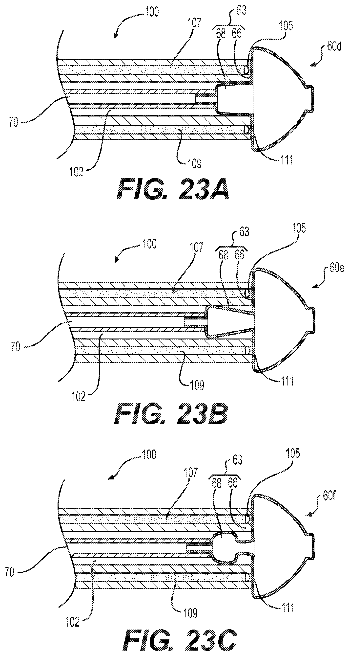 Patent US11779196 Figure 14 – Gastrointestinal endoscopy with attachable intestine pleating structures