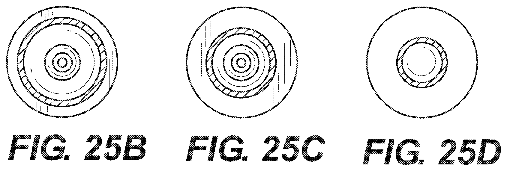 Patent US11779196 Figure 17 – Gastrointestinal endoscopy with attachable intestine pleating structures