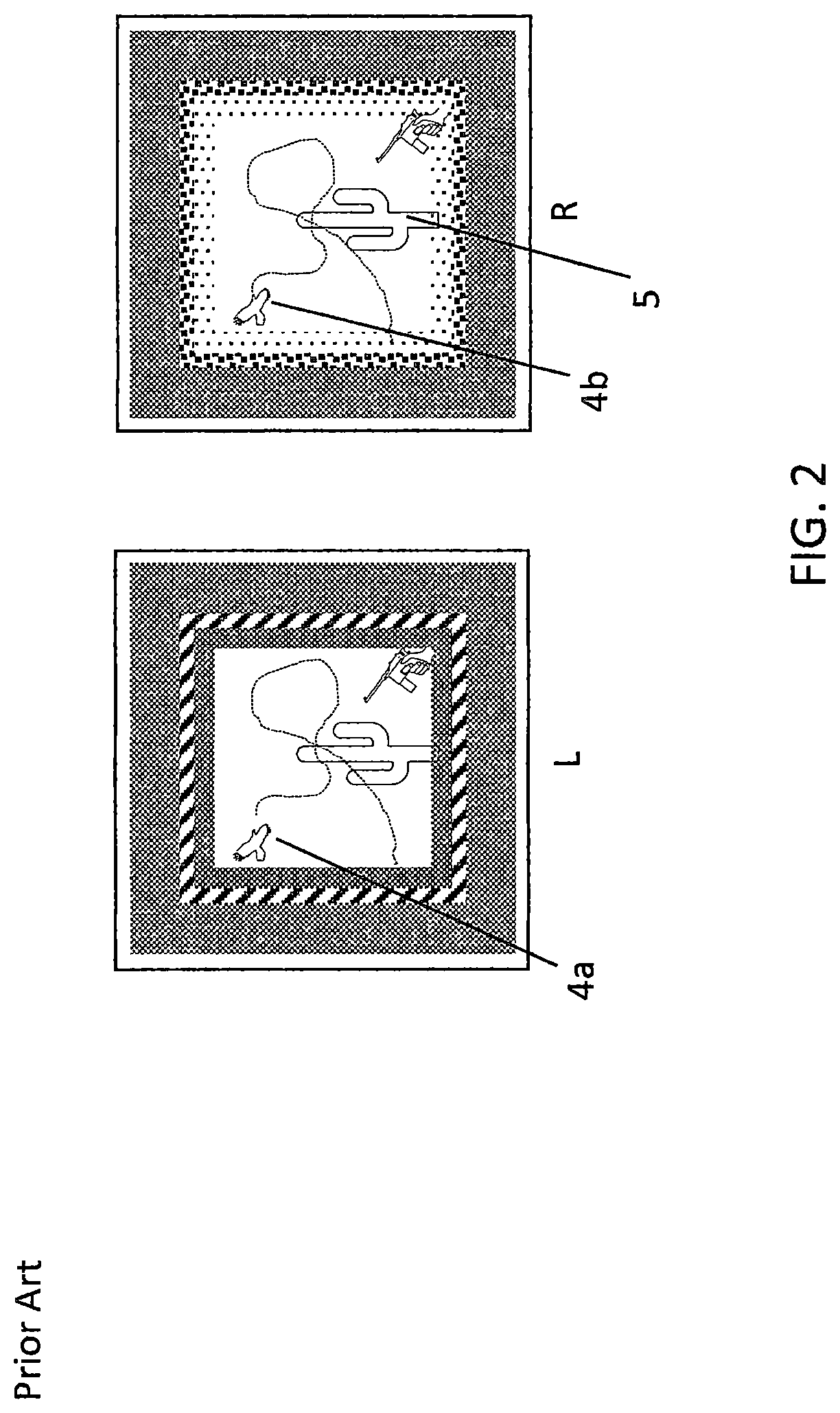 Patent US11779203 Figure 2 – Animated stereoscopic illusionary therapy and entertainment