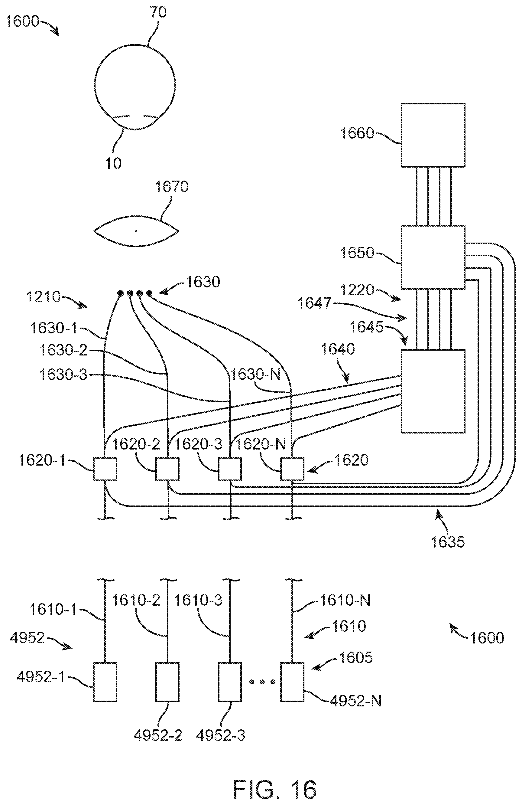 Patent US11779206 Figure 18 – Axial length measurement monitor