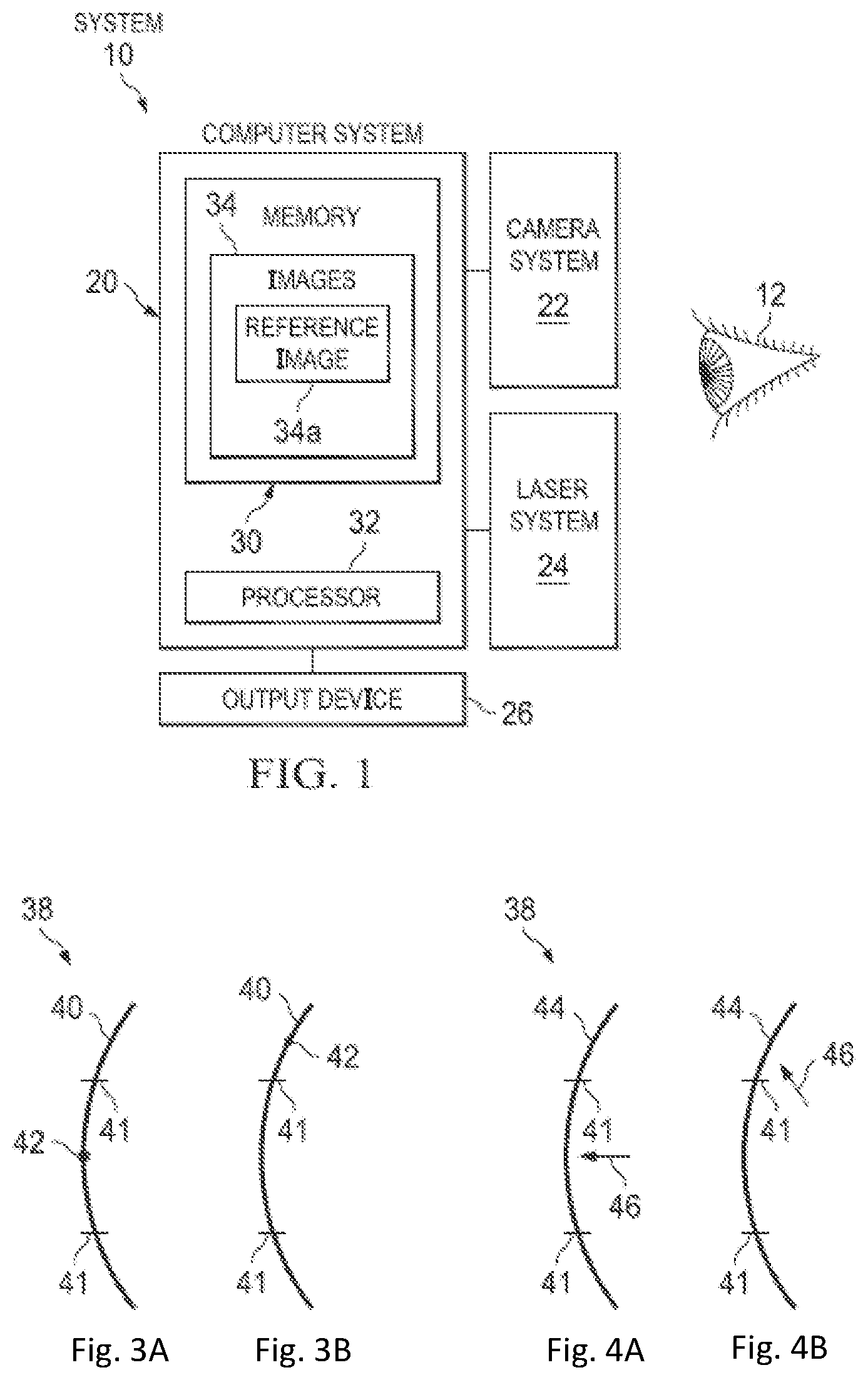 Patent US11779208 Figure 1 – Tracking movement of an eye within a tracking range