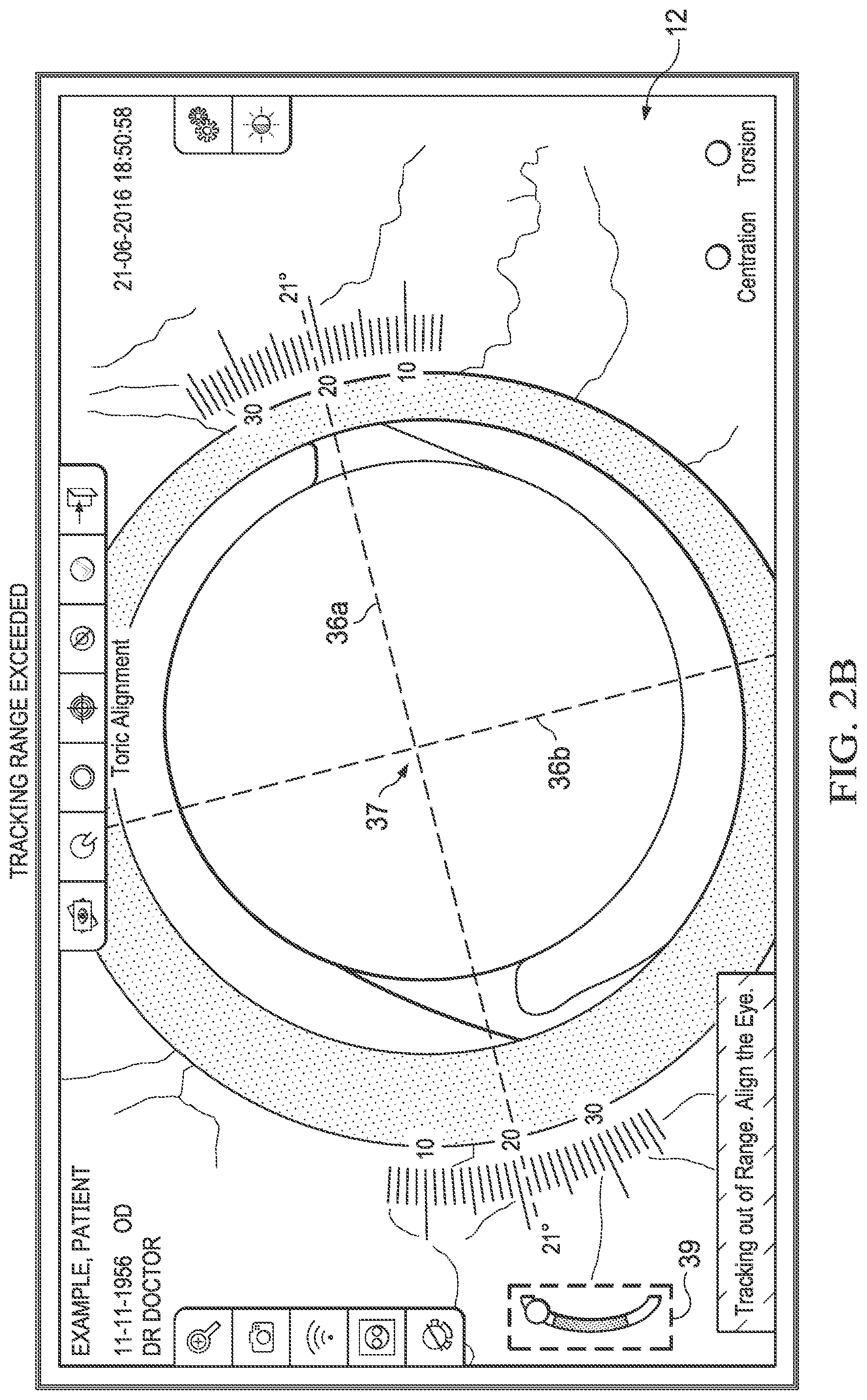 Patent US11779208 Figure 3 – Tracking movement of an eye within a tracking range