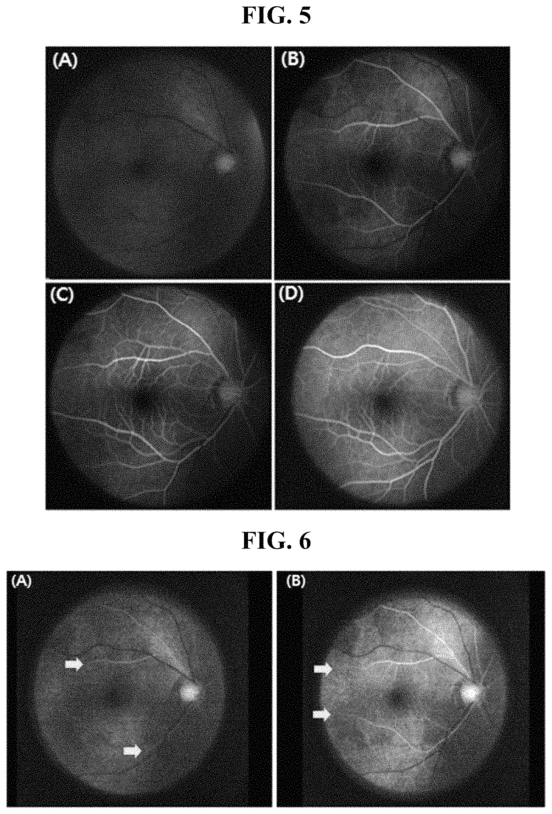 Patent US11779211 Figure 3 – Fluorescein fluorescent fundus angiography device employing polarizing beam splitter and linear polarizing filter