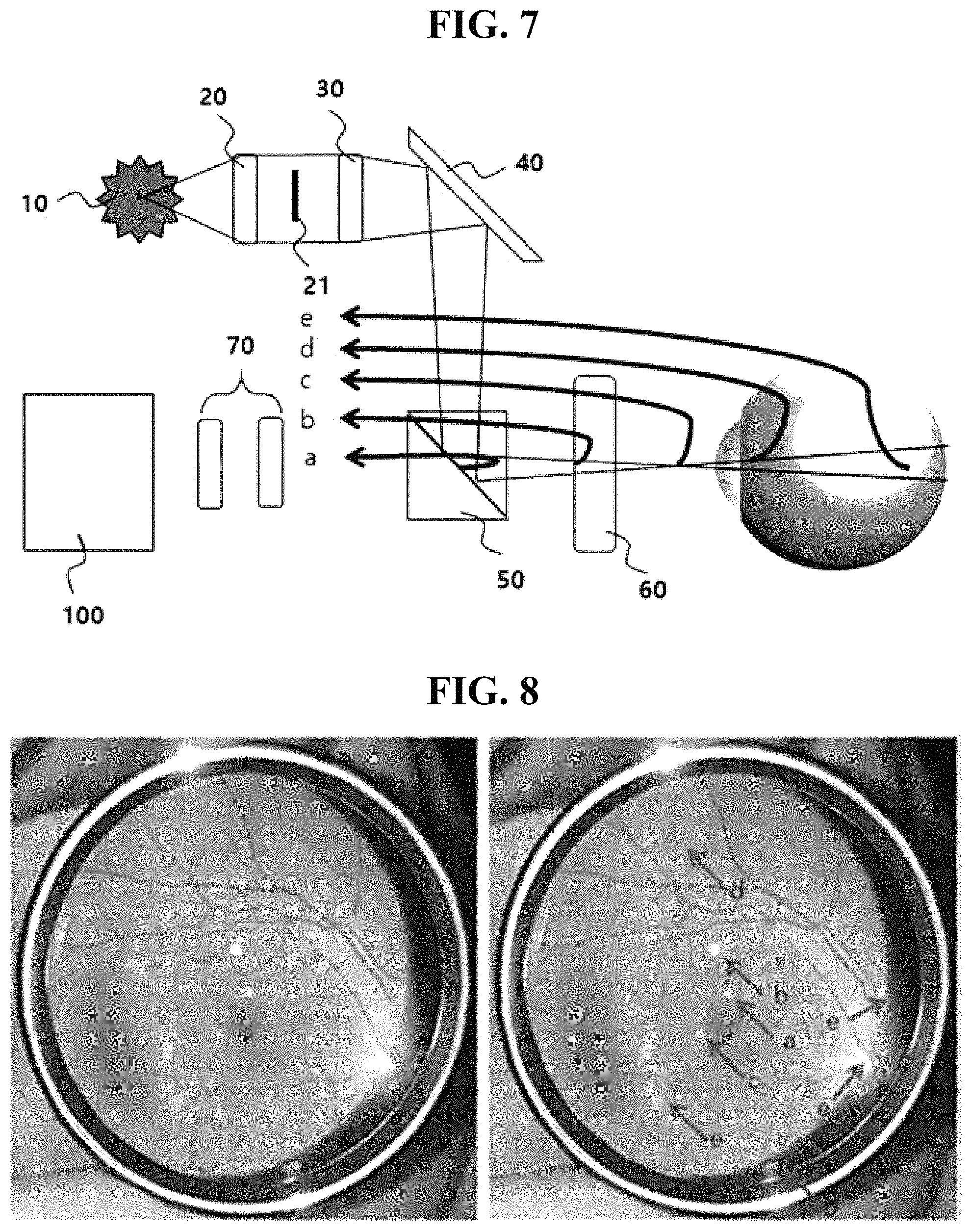 Patent US11779211 Figure 4 – Fluorescein fluorescent fundus angiography device employing polarizing beam splitter and linear polarizing filter