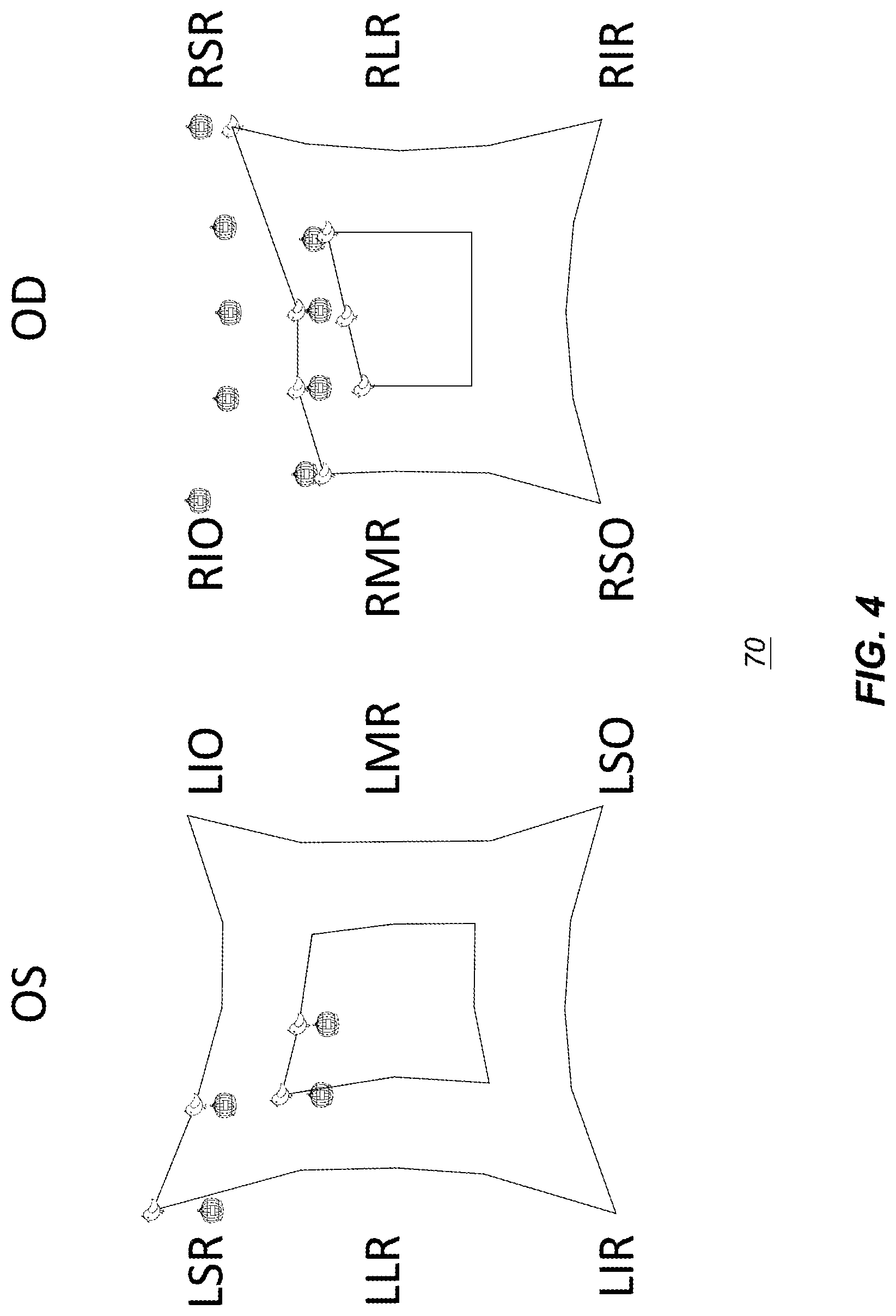 Patent US11779214 Figure 5 – Systems and methods for measuring and classifying ocular misalignment