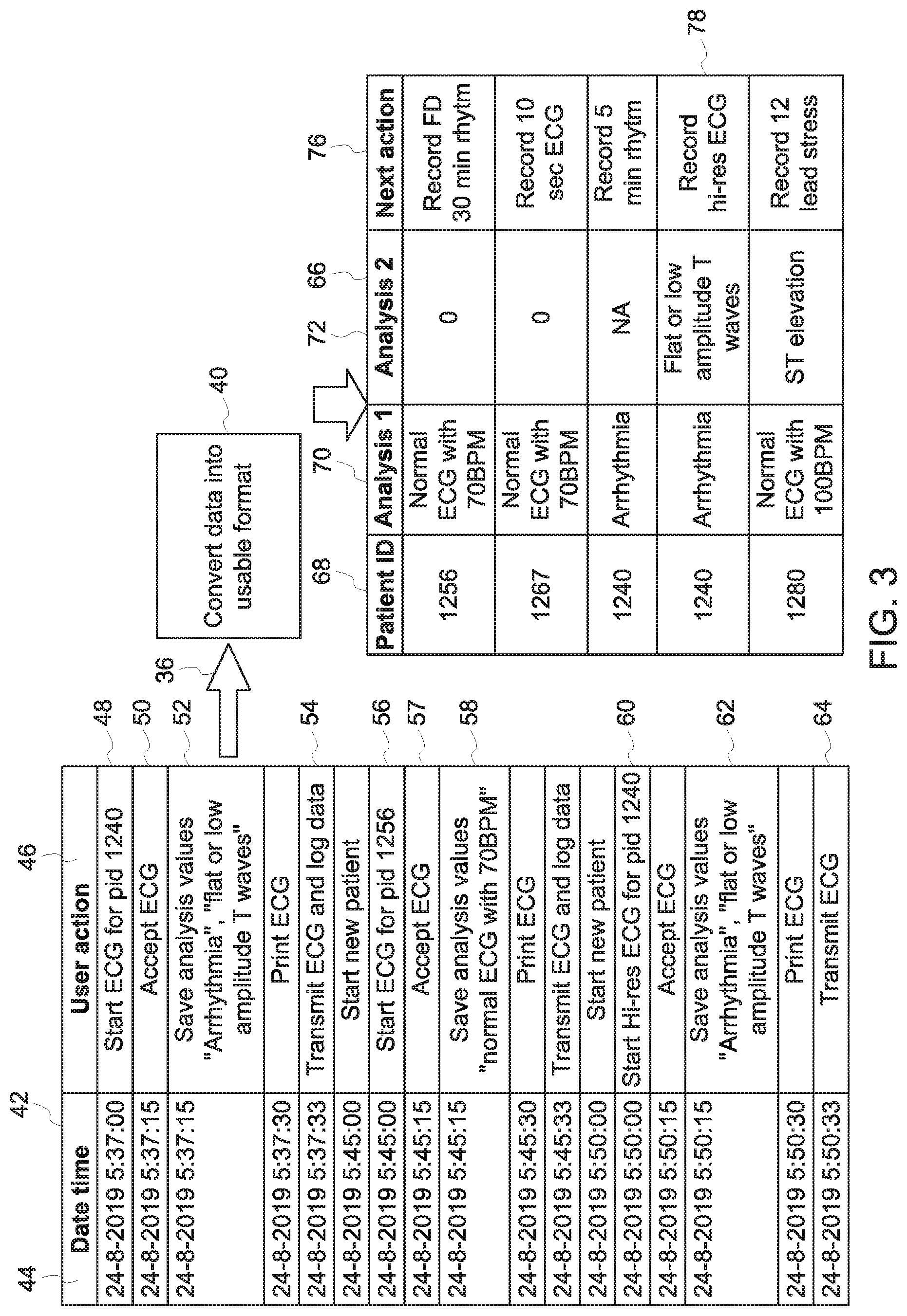 Patent US11779215 Figure 3 – Enhanced ECG workflows