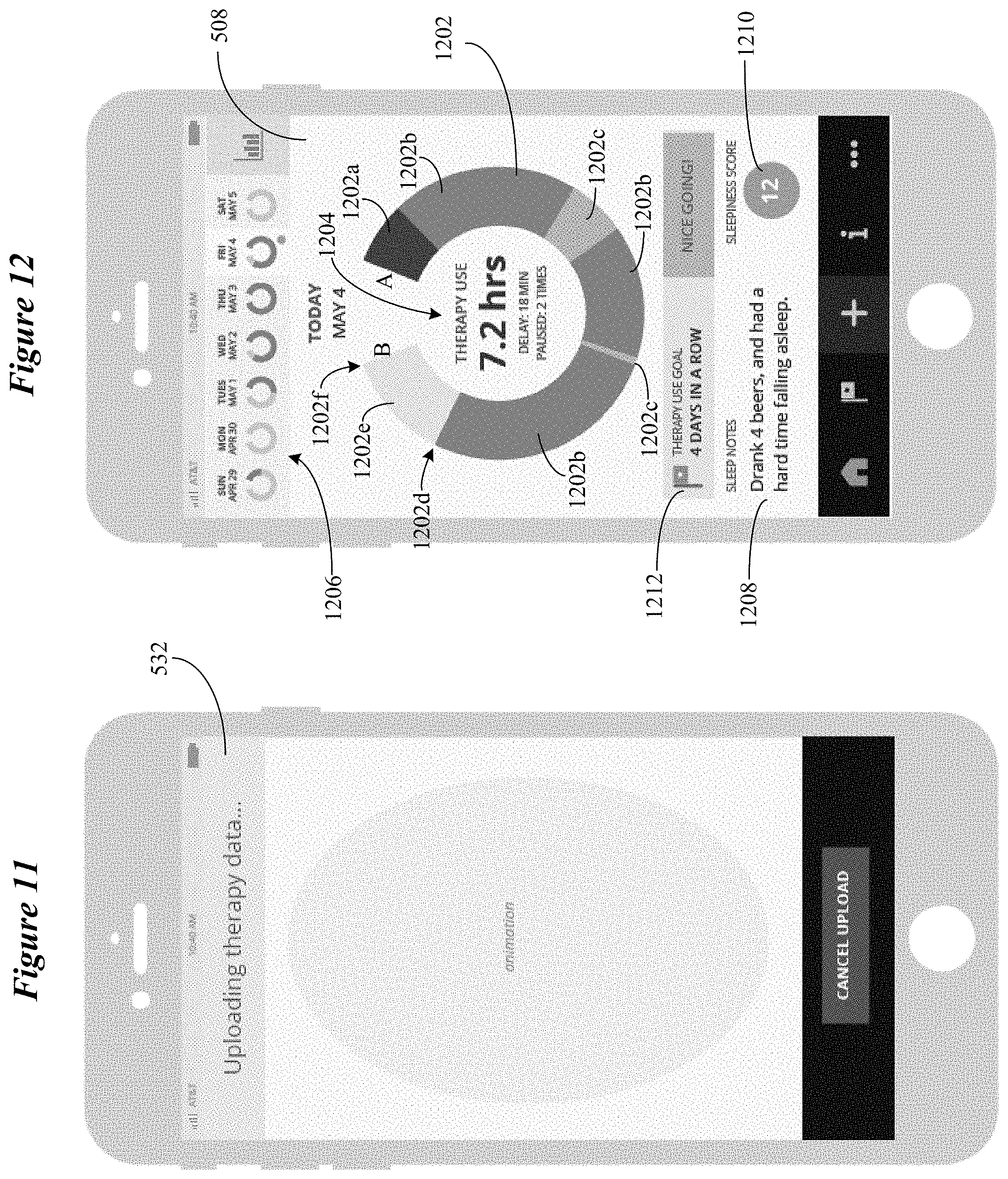 Patent US11779217 Figure 11 – System and method for collecting and displaying data acquired from an implantable therapy device using a consumer electronic device