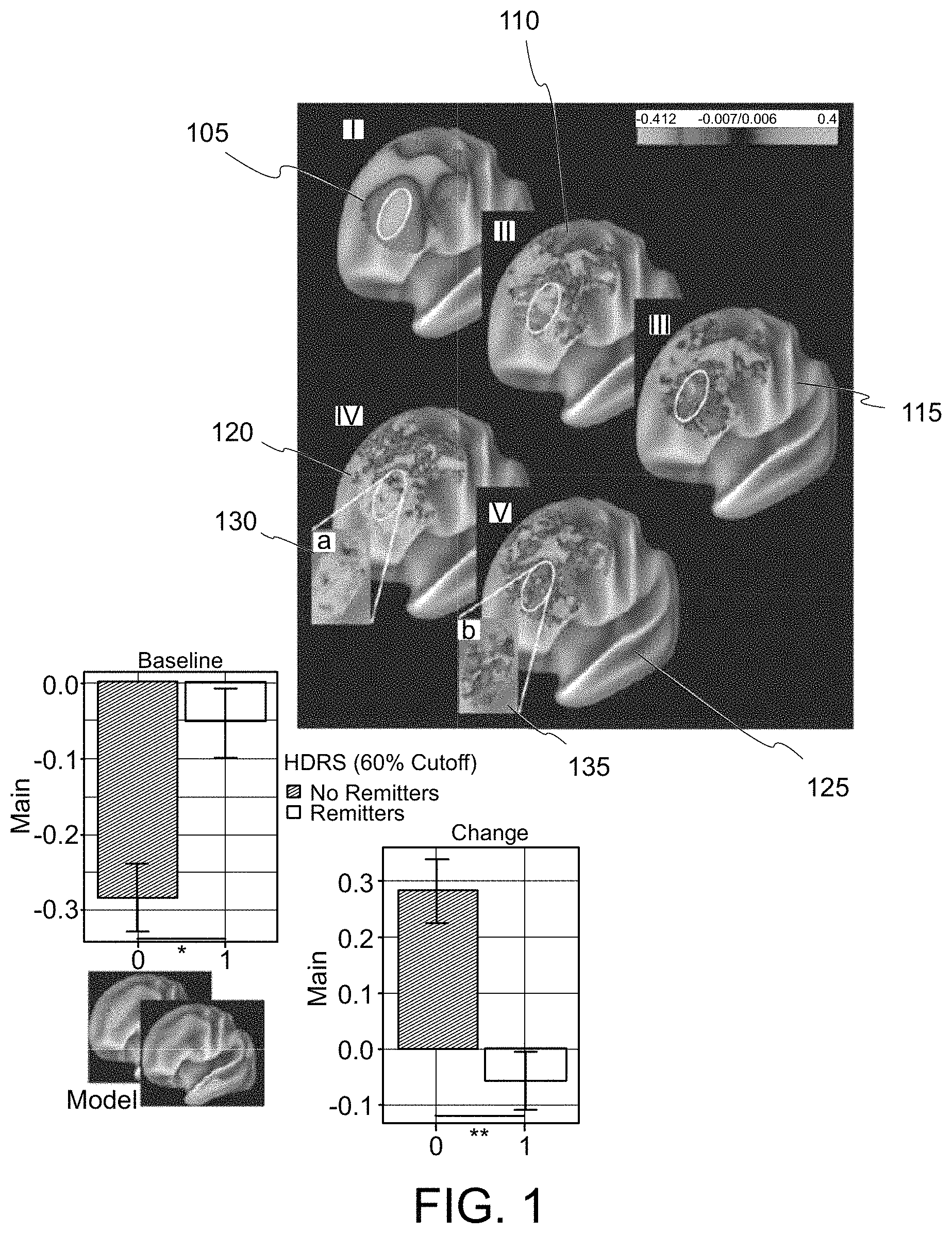Patent US11779218 — System, method and computer-accessible medium for predicting response to electroconvulsice therapy based on brain functional connectivity patterns — Figure 1
