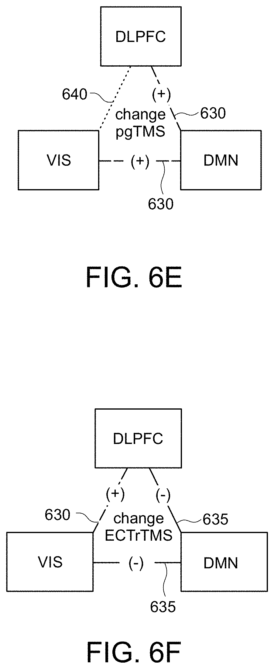 Patent US11779218 Figure 10 – System, method and computer-accessible medium for predicting response to electroconvulsice therapy based on brain functional connectivity patterns