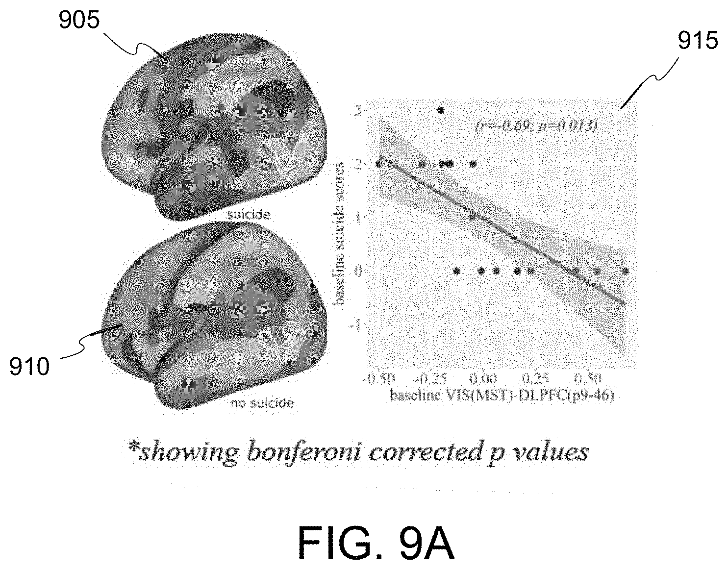 Patent US11779218 Figure 13 – System, method and computer-accessible medium for predicting response to electroconvulsice therapy based on brain functional connectivity patterns